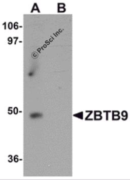 Western blot analysis of ZBTB9 in mouse heart tissue lysate with ZBTB9 antibody at 1 μg/mL in (A) the absence and (B) the presence of blocking peptide.