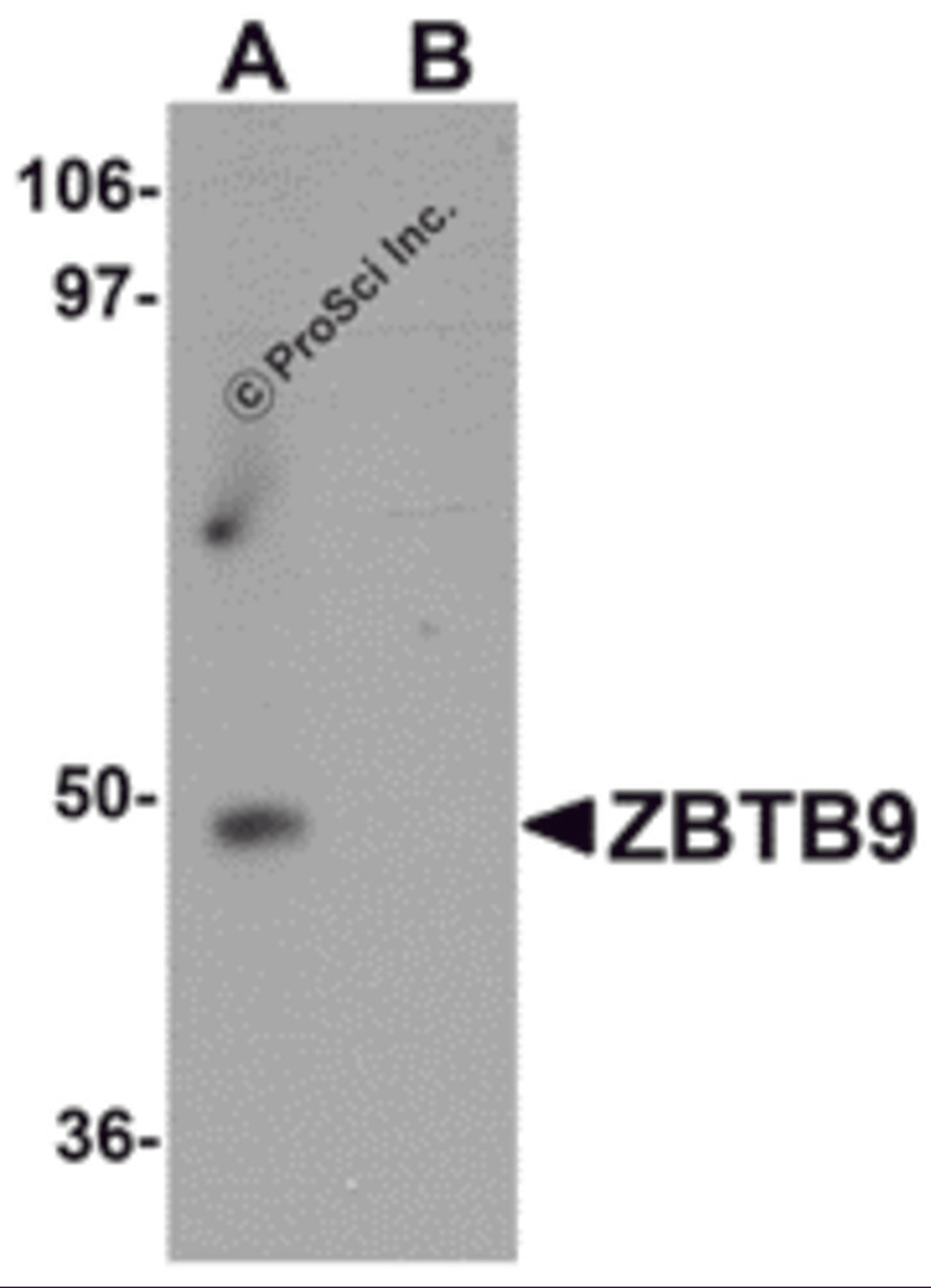 Western blot analysis of ZBTB9 in mouse heart tissue lysate with ZBTB9 antibody at 1 μg/mL in (A) the absence and (B) the presence of blocking peptide.