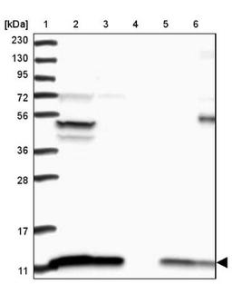 Western Blot: ATP5J Antibody [NBP1-88888] - Lane 1: Marker [kDa] 230, 130, 95, 72, 56, 36, 28, 17, 11<br/>Lane 2: Human cell line RT-4<br/>Lane 3: Human cell line U-251MG sp<br/>Lane 4: Human plasma (IgG/HSA depleted)<br/>Lane 5: Human liver tissue<br/>Lane 6: Human tonsil tissue