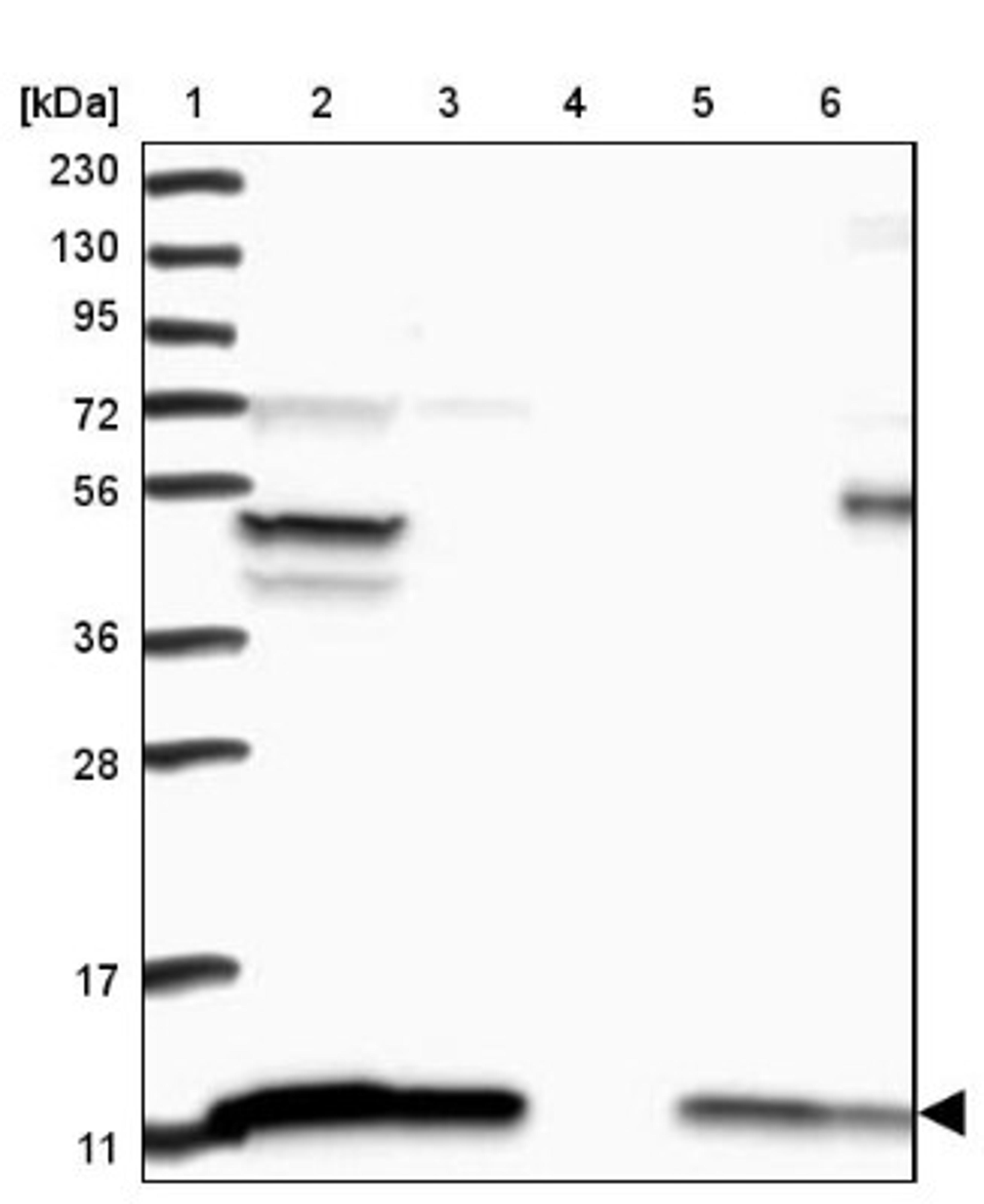 Western Blot: ATP5J Antibody [NBP1-88888] - Lane 1: Marker [kDa] 230, 130, 95, 72, 56, 36, 28, 17, 11<br/>Lane 2: Human cell line RT-4<br/>Lane 3: Human cell line U-251MG sp<br/>Lane 4: Human plasma (IgG/HSA depleted)<br/>Lane 5: Human liver tissue<br/>Lane 6: Human tonsil tissue