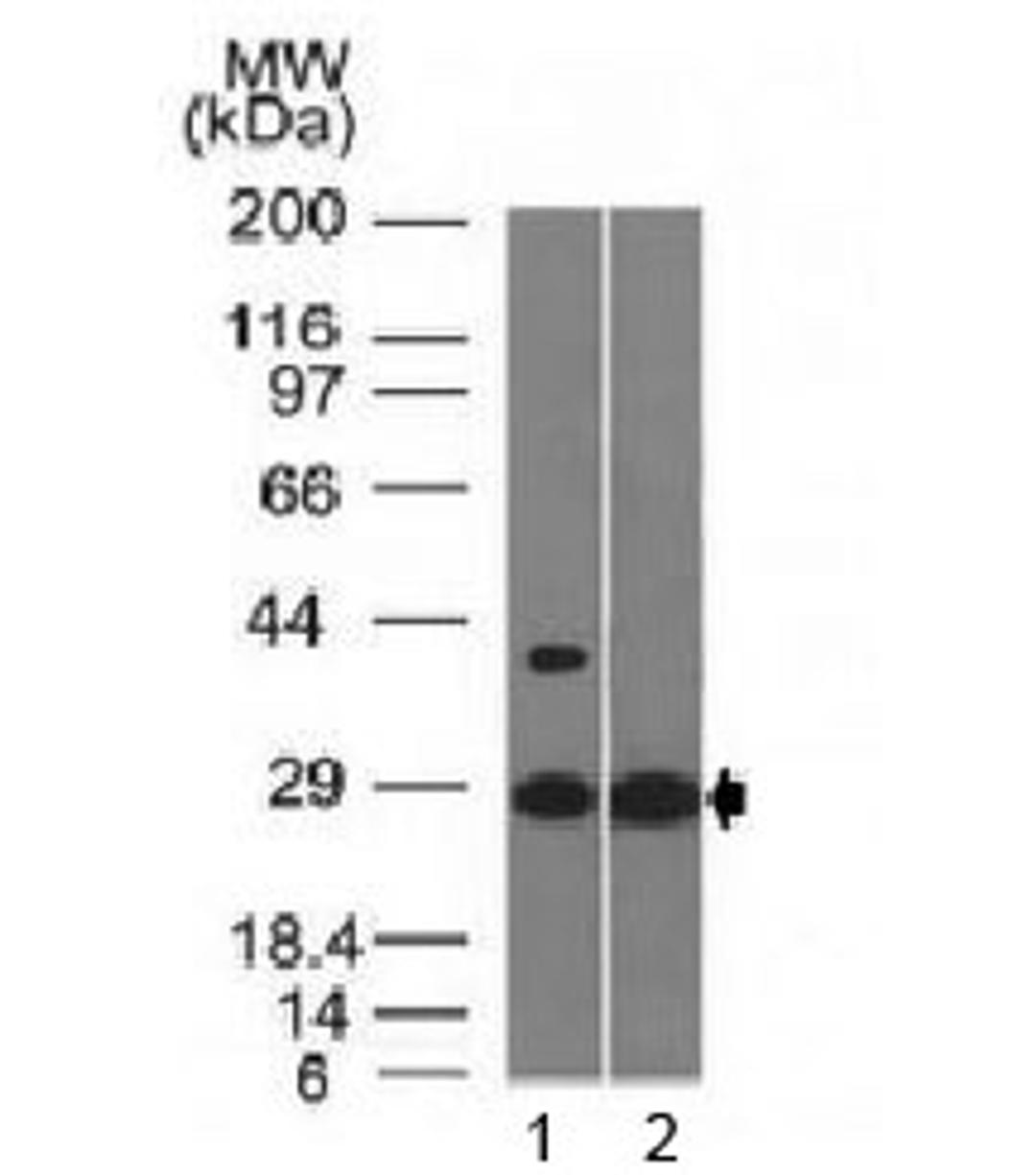 Western blot testing of with EPO antibody (clone EPO/1368). Predicted molecular weight: 18-34 kDa depending on glycosylation level.