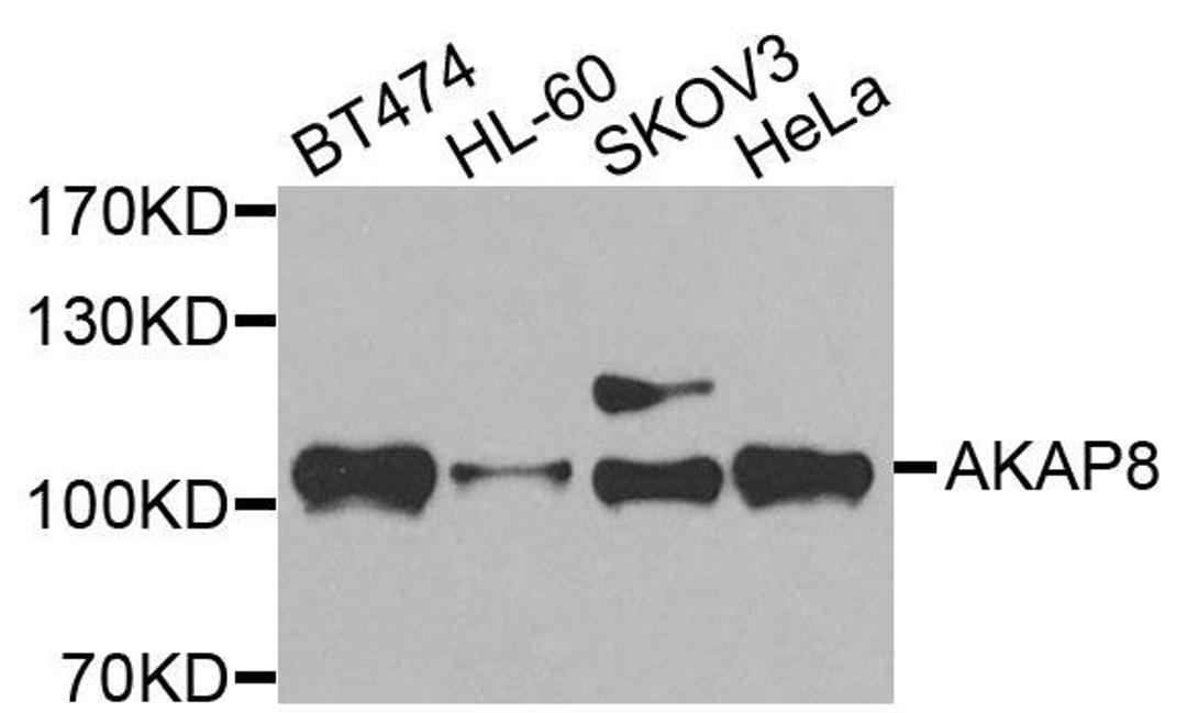 Western blot analysis of extracts of various cells using AKAP8 antibody