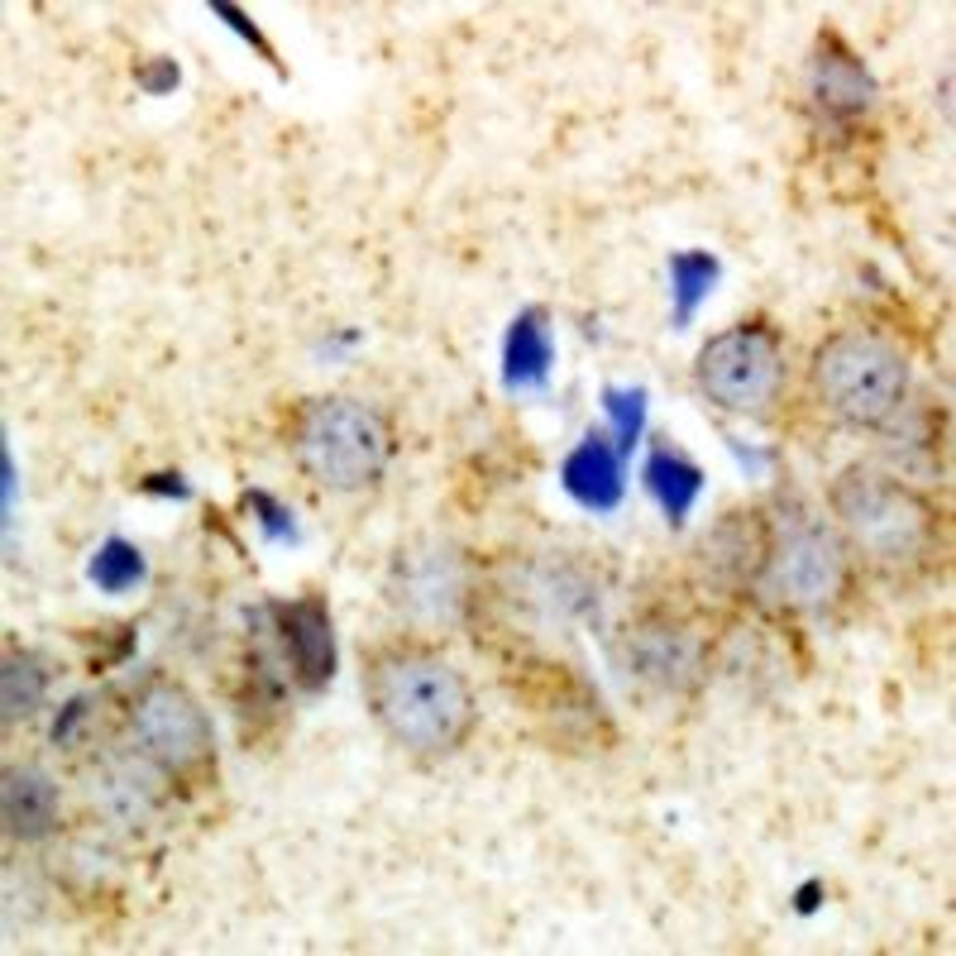 Immunohistochemical staining of rat brain tissue using CPA6 antibody