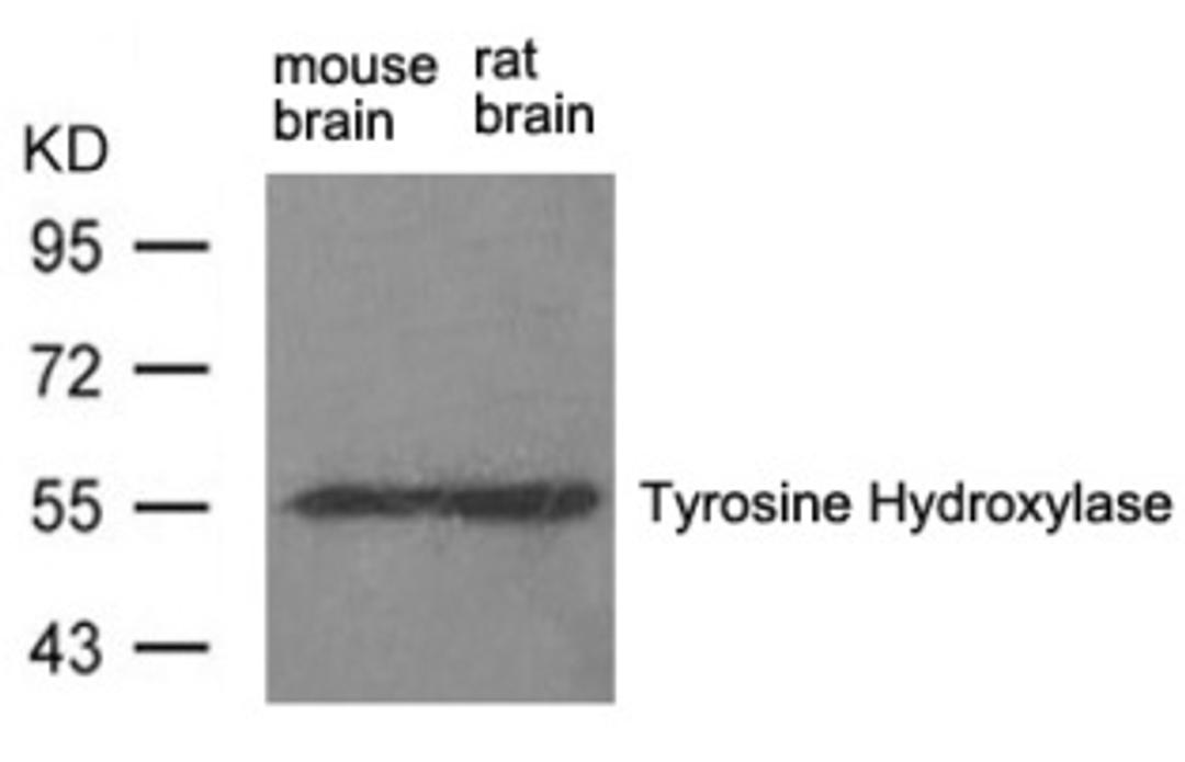 Western blot analysis of extract from rat brain and mouse brain using Tyrosine Hydroxylase (Ab-31).