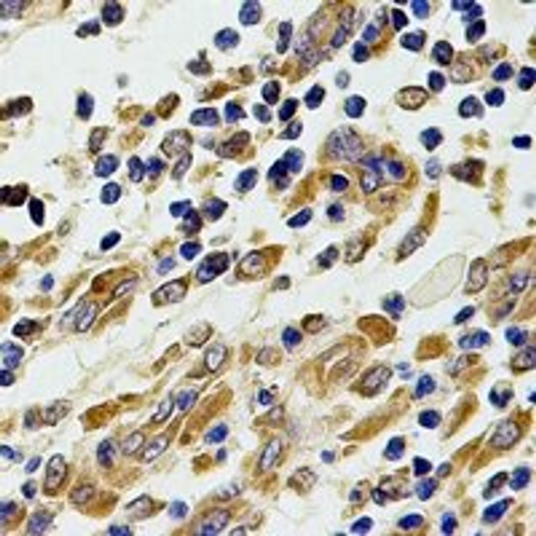 Immunohistochemical staining of human stomach tissue using CHIT1 antibody