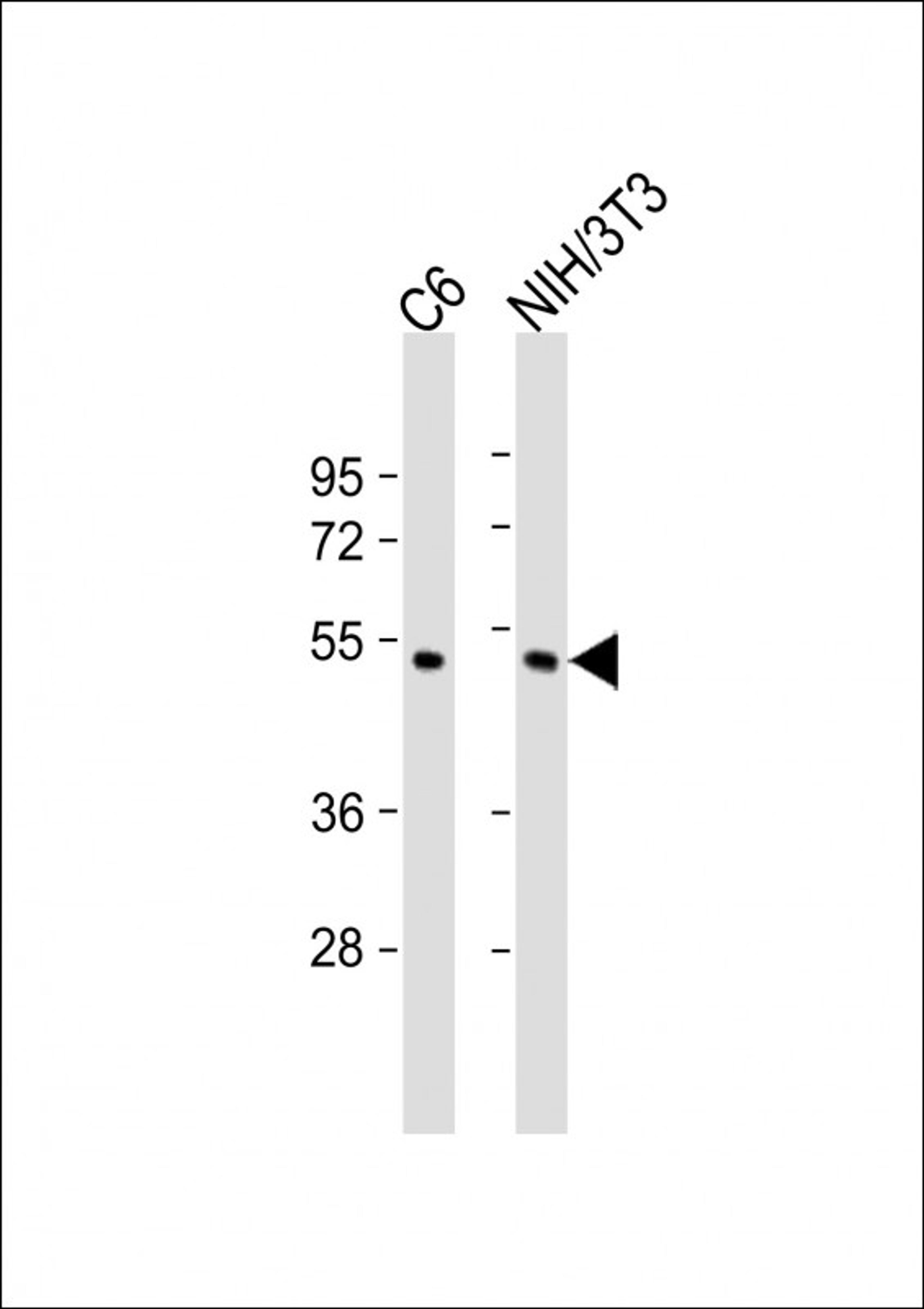 Western Blot at 1:2000 dilution Lane 1: C6 whole cell lysate Lane 2: NIH/3T3 whole cell lysate Lysates/proteins at 20 ug per lane.