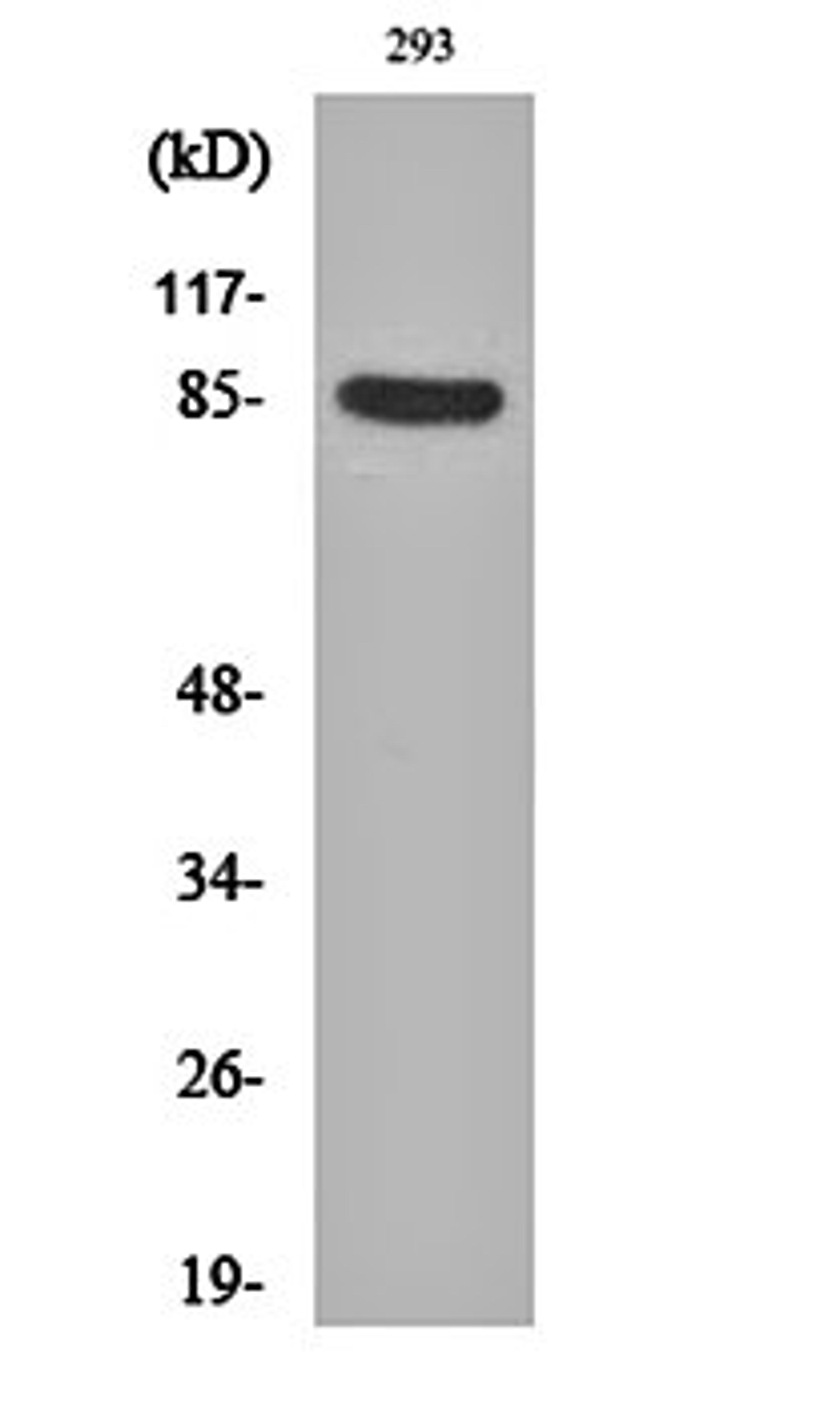 Western blot analysis of 293 cell lysates using Cortactin (phospho-Y466) antibody