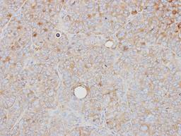 Immunohistochemistry-Paraffin: PRPS1 Antibody [NBP1-31654] - Paraffin-embedded SW480 xenograft, using antibody at 1:500 dilution.