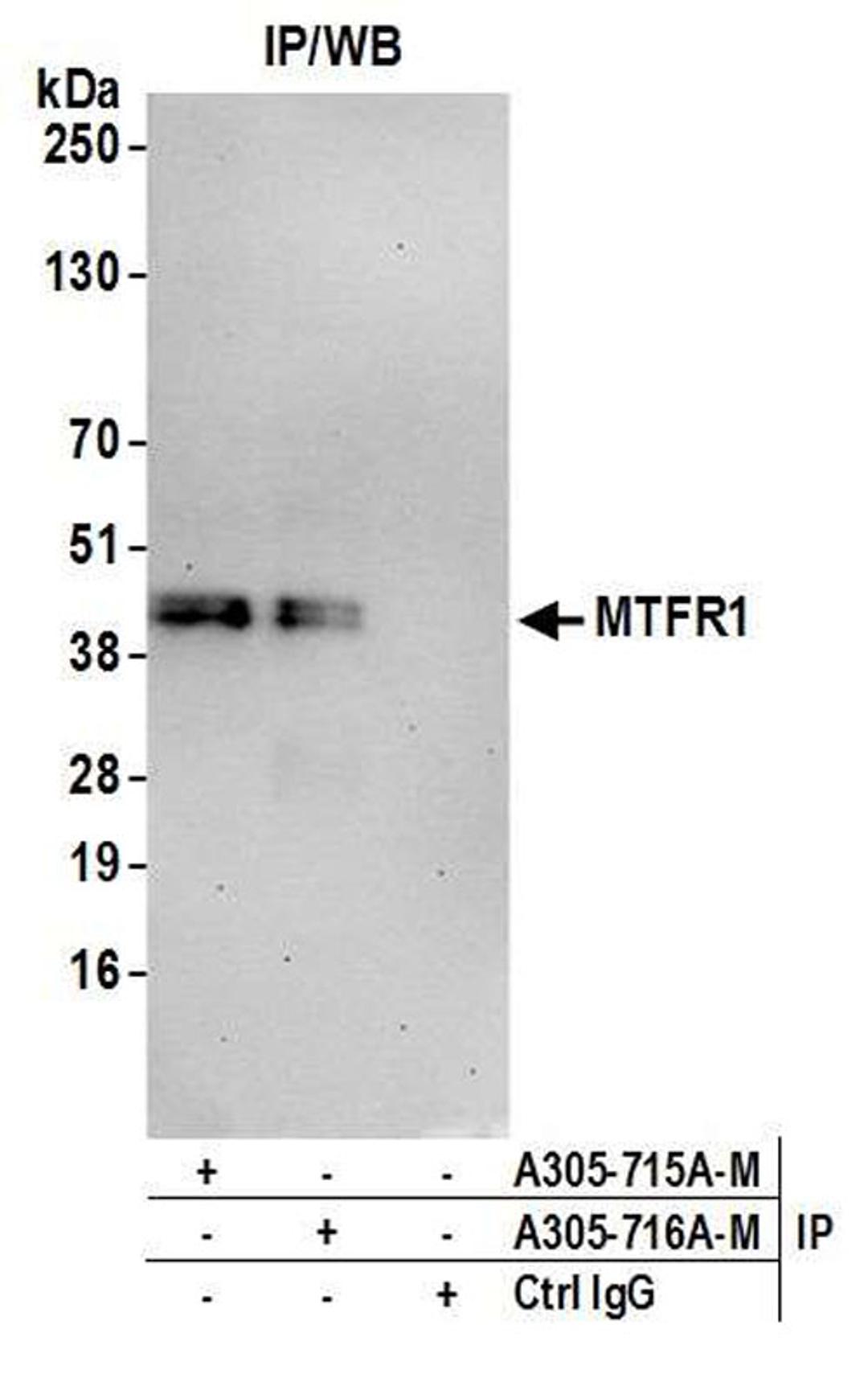 Detection of human MTFR1 by WB of IP.