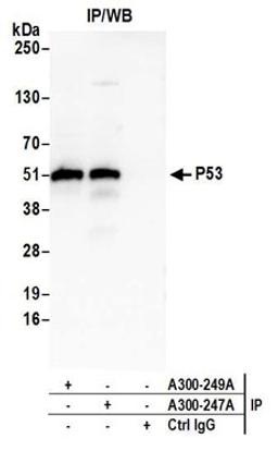 Detection of human P53 by western blot of immunoprecipitates.