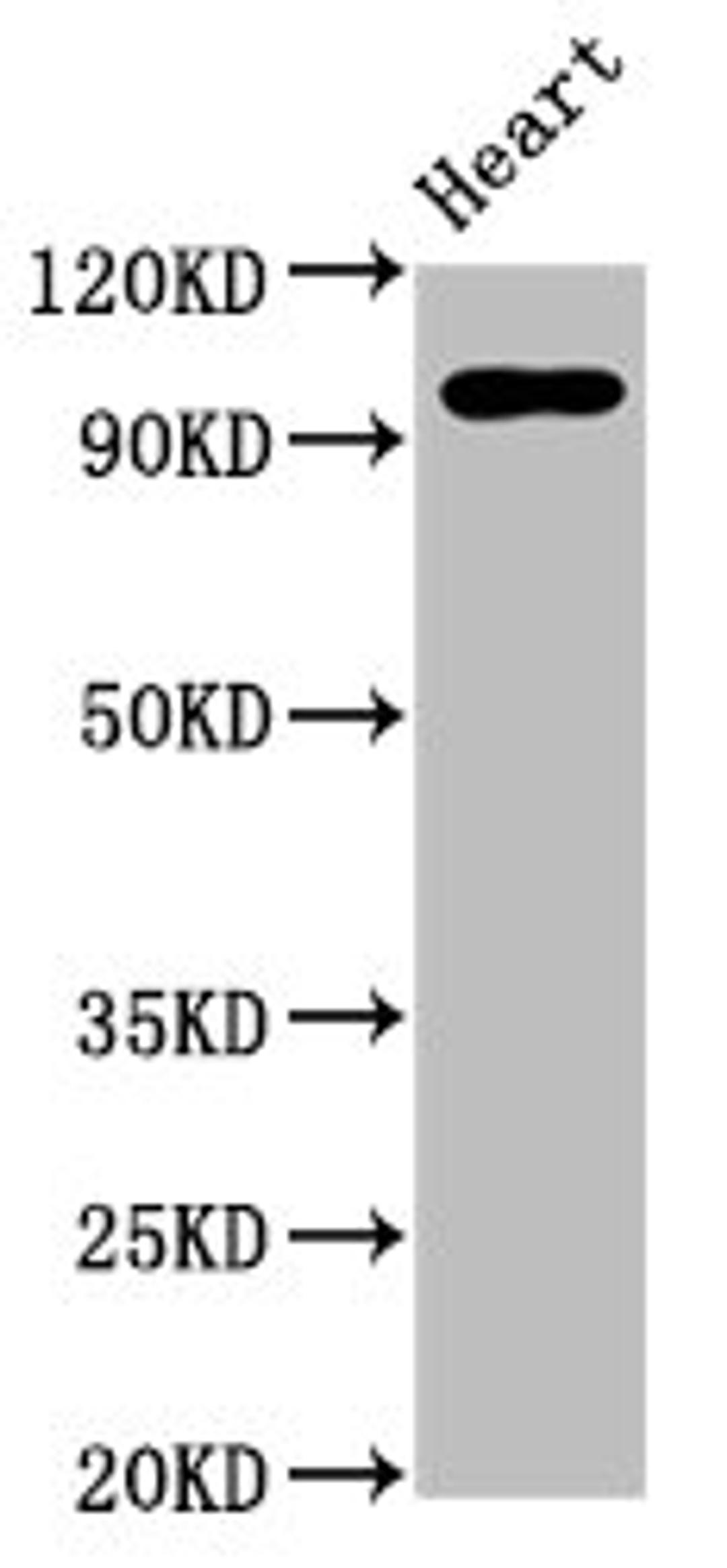 Western Blot. Positive WB detected in: Rat heart tissue. All lanes: GRM2 antibody at 5ug/ml. Secondary. Goat polyclonal to rabbit IgG at 1/50000 dilution. Predicted band size: 96 kDa. Observed band size: 96 kDa. 