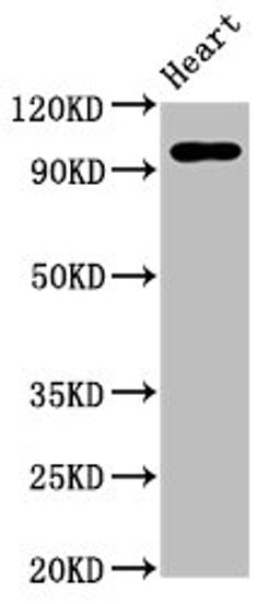 Western Blot. Positive WB detected in: Rat heart tissue. All lanes: GRM2 antibody at 5ug/ml. Secondary. Goat polyclonal to rabbit IgG at 1/50000 dilution. Predicted band size: 96 kDa. Observed band size: 96 kDa. 