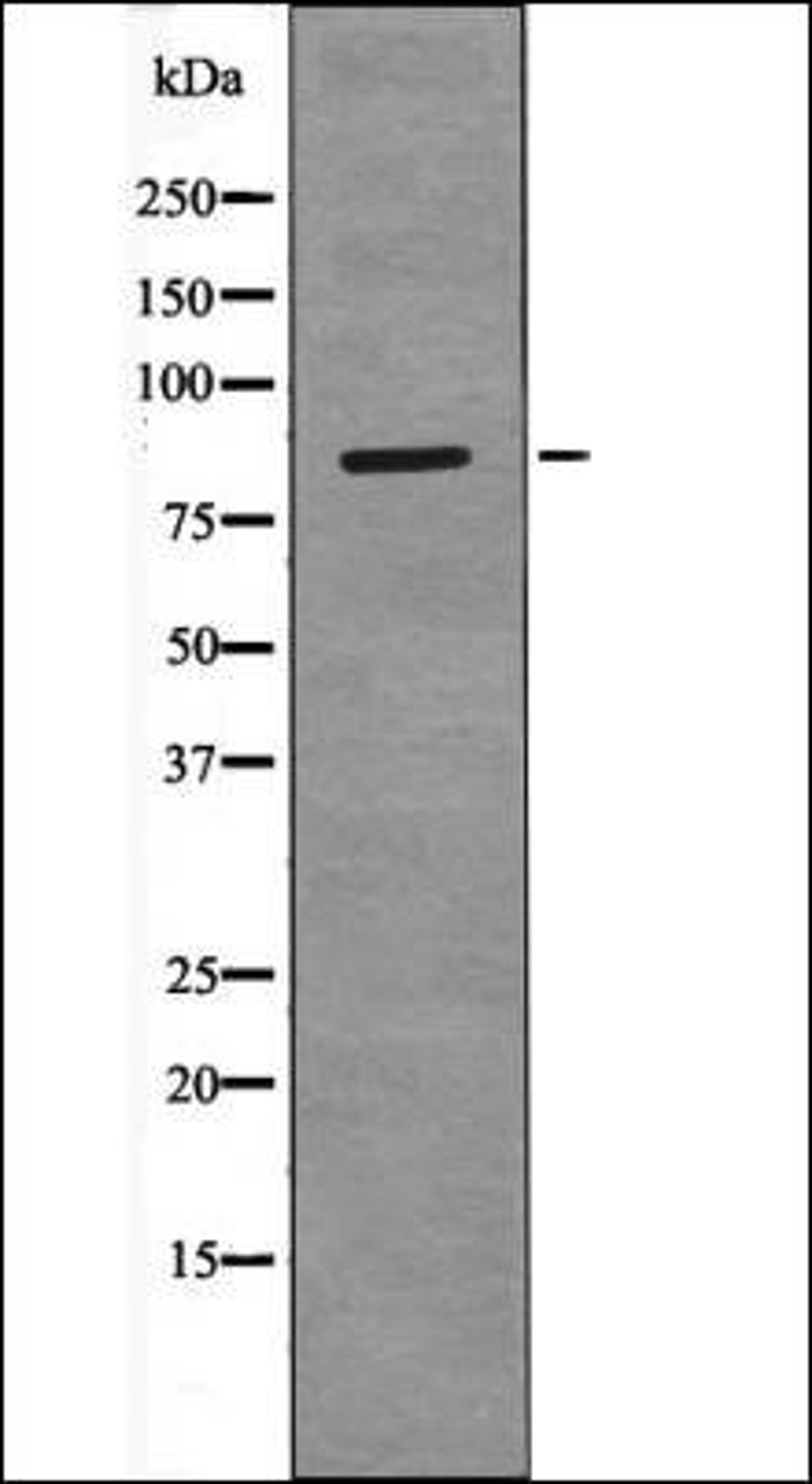 Western blot analysis of RAW264.7 whole cell lysates using PECAM-1 -Phospho-Tyr690- antibody