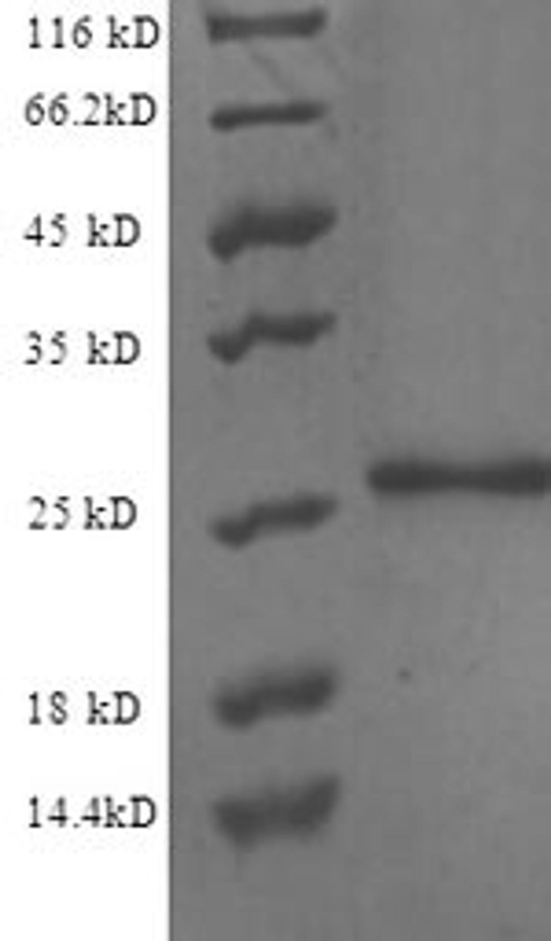 (Tris-Glycine gel) Discontinuous SDS-PAGE (reduced) with 5% enrichment gel and 15% separation gel.