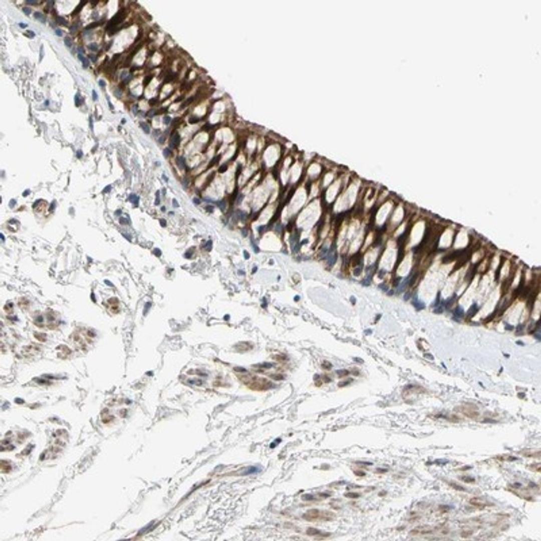 Immunohistochemistry-Paraffin: FAM189B Antibody [NBP1-88343] - Staining of human bronchus shows strong cytoplasmic positivity in respiratory epithelial cells.