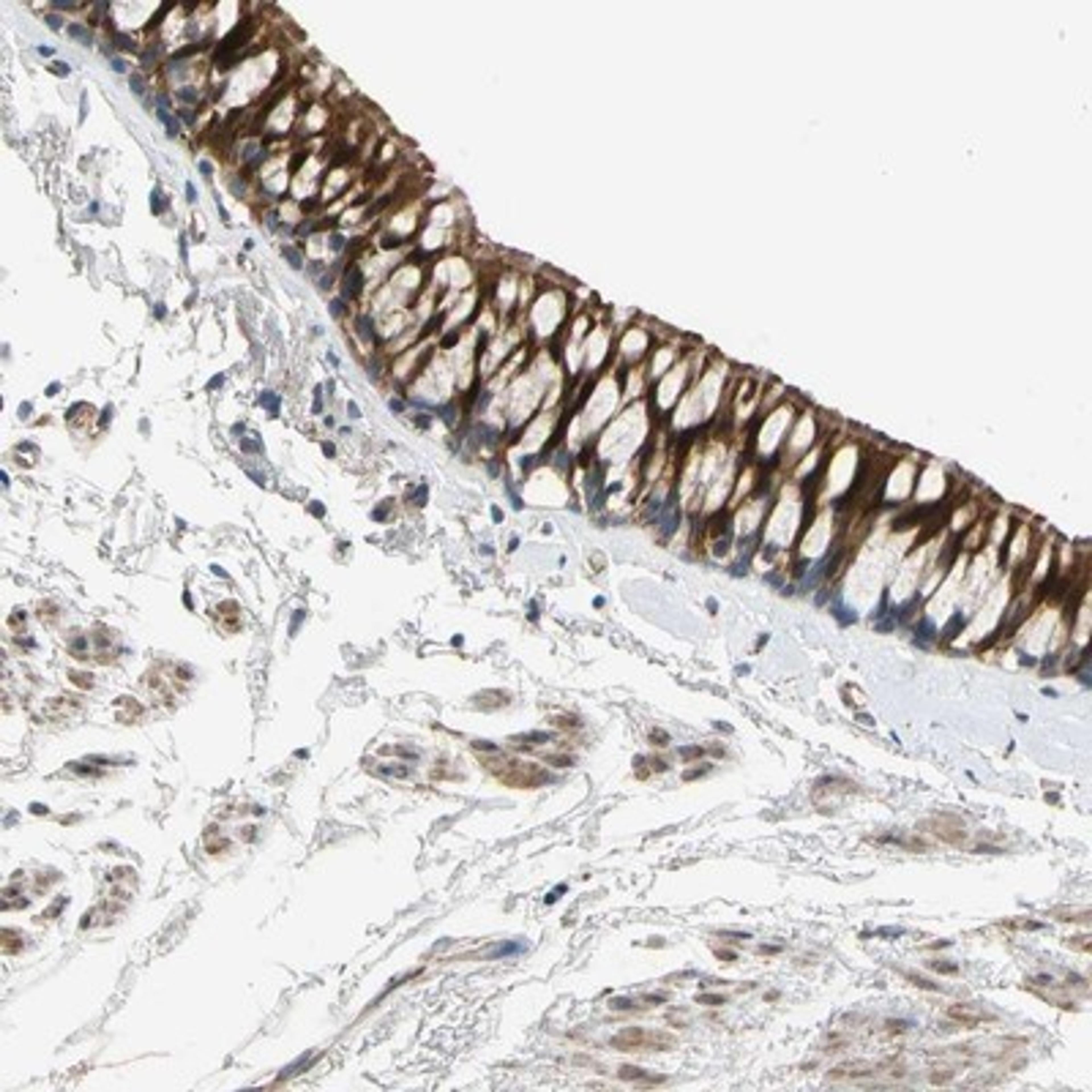 Immunohistochemistry-Paraffin: FAM189B Antibody [NBP1-88343] - Staining of human bronchus shows strong cytoplasmic positivity in respiratory epithelial cells.