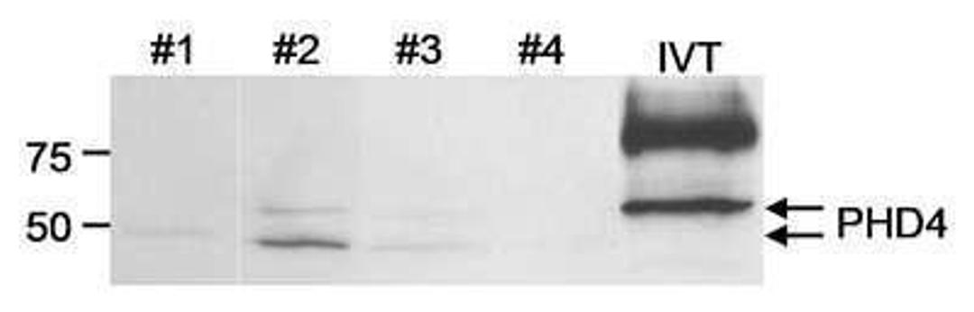 Western Blot: HIF Prolyl Hydroxylase 4 Antibody [NB100-295] - Whole cell lysate (25 mcg/lane) from human glioblastoma tumor cell lines or in vitro translated PHD4.  Antibody: Affinity purified rabbit anti-PHD4 (Cat. No. NB100-295) used at 2 mcg/ml.  Detection: Chemiluminescence