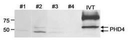 Western Blot: HIF Prolyl Hydroxylase 4 Antibody [NB100-295] - Whole cell lysate (25 mcg/lane) from human glioblastoma tumor cell lines or in vitro translated PHD4.  Antibody: Affinity purified rabbit anti-PHD4 (Cat. No. NB100-295) used at 2 mcg/ml.  Detection: Chemiluminescence