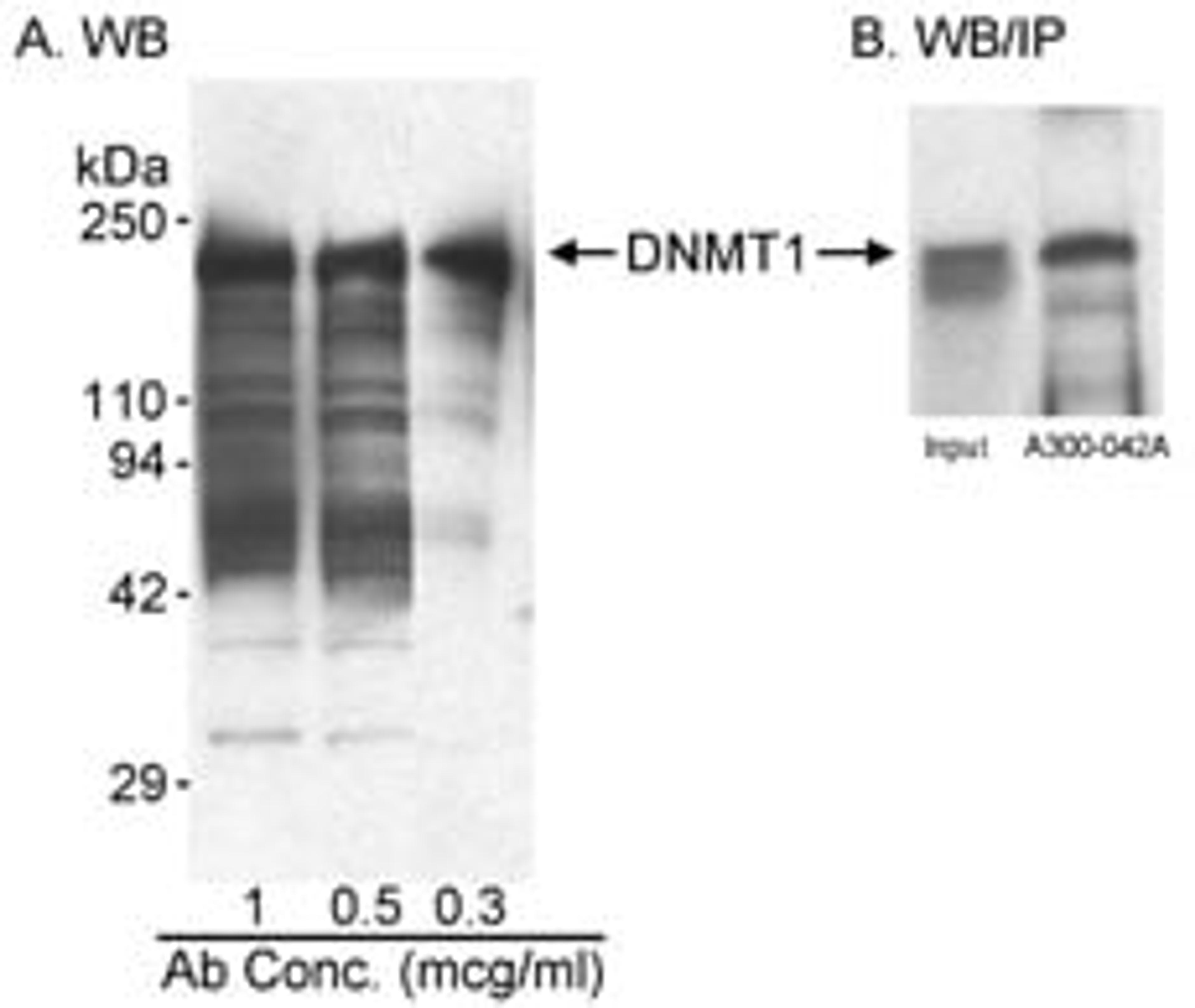 Detection of human DNMT1 by western blot and immunoprecipitation.