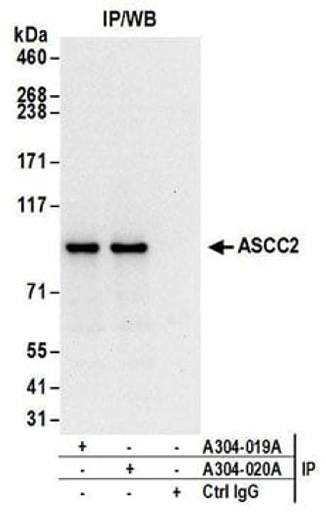 Detection of human ASCC2 by western blot of immunoprecipitates.