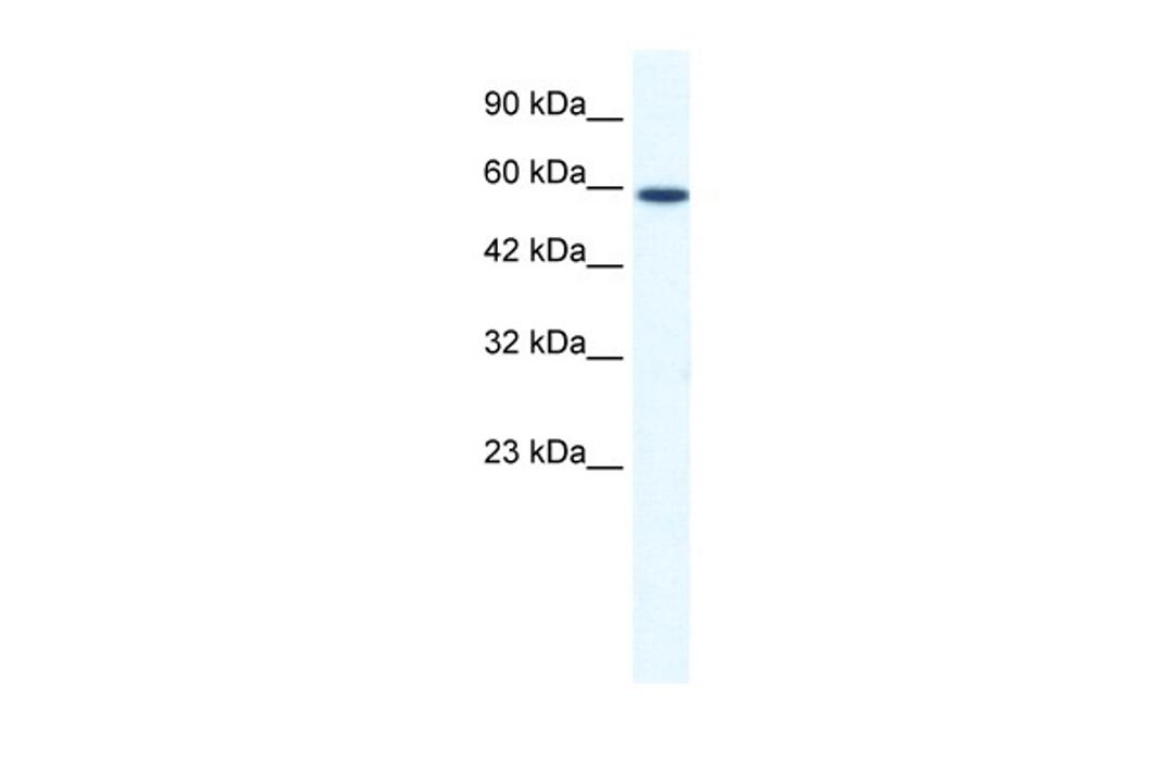 Antibody used in WB on Human Jurkat 1.25 ug/ml.