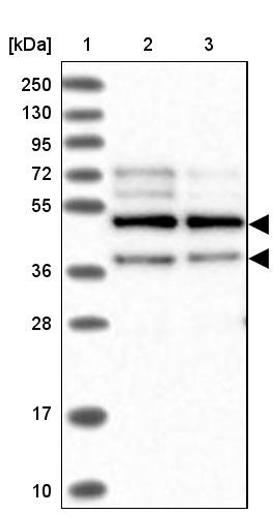 Western Blot: PPHLN1 Antibody [NBP1-89480] - Lane 1: Marker [kDa] 250, 130, 95, 72, 55, 36, 28, 17, 10<br/>Lane 2: Human cell line RT-4<br/>Lane 3: Human cell line U-251MG sp