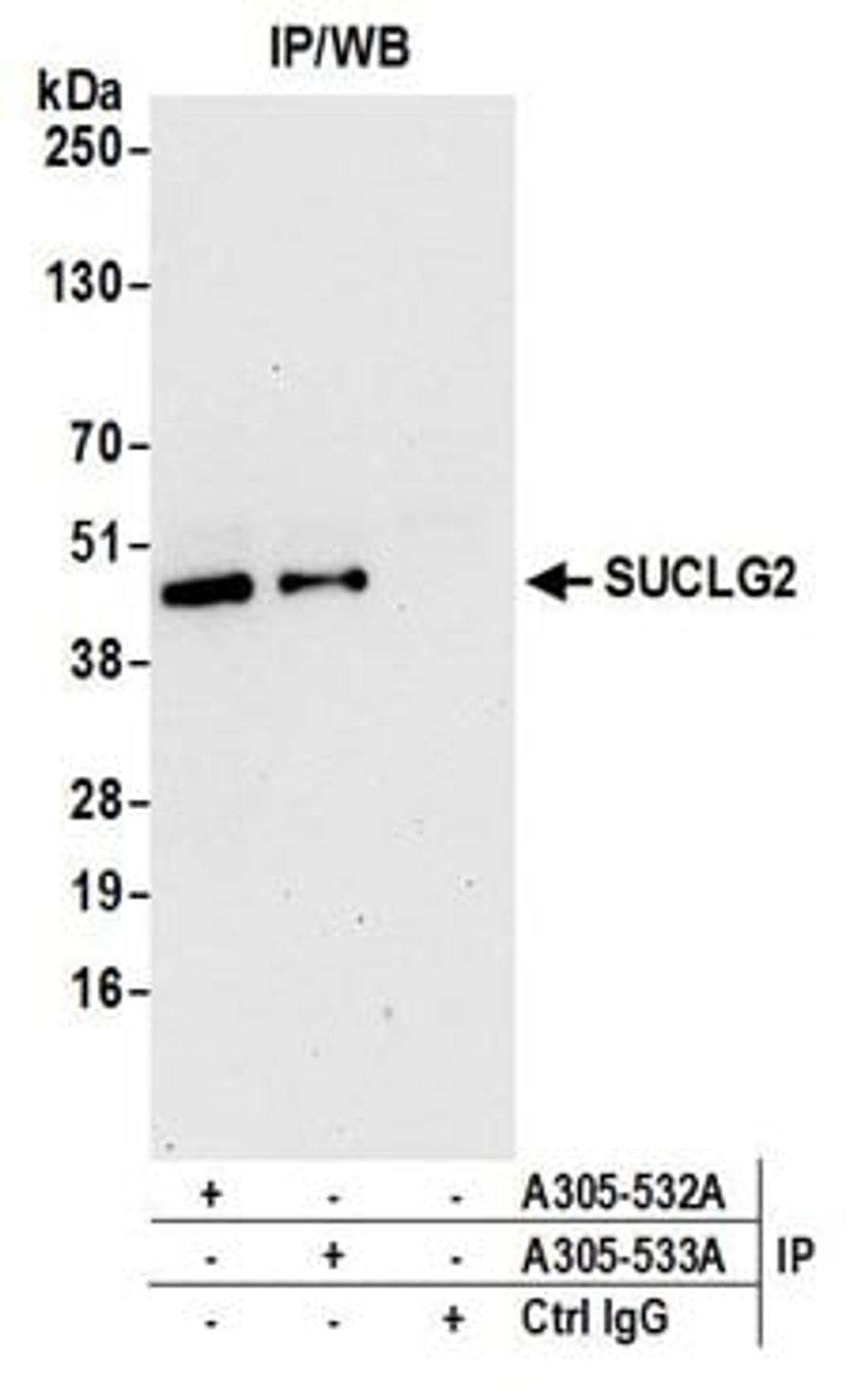 Detection of human SUCLG2 by western blot of immunoprecipitates.