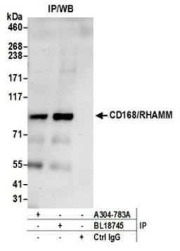 Detection of human CD168/RHAMM by western blot of immunoprecipitates.