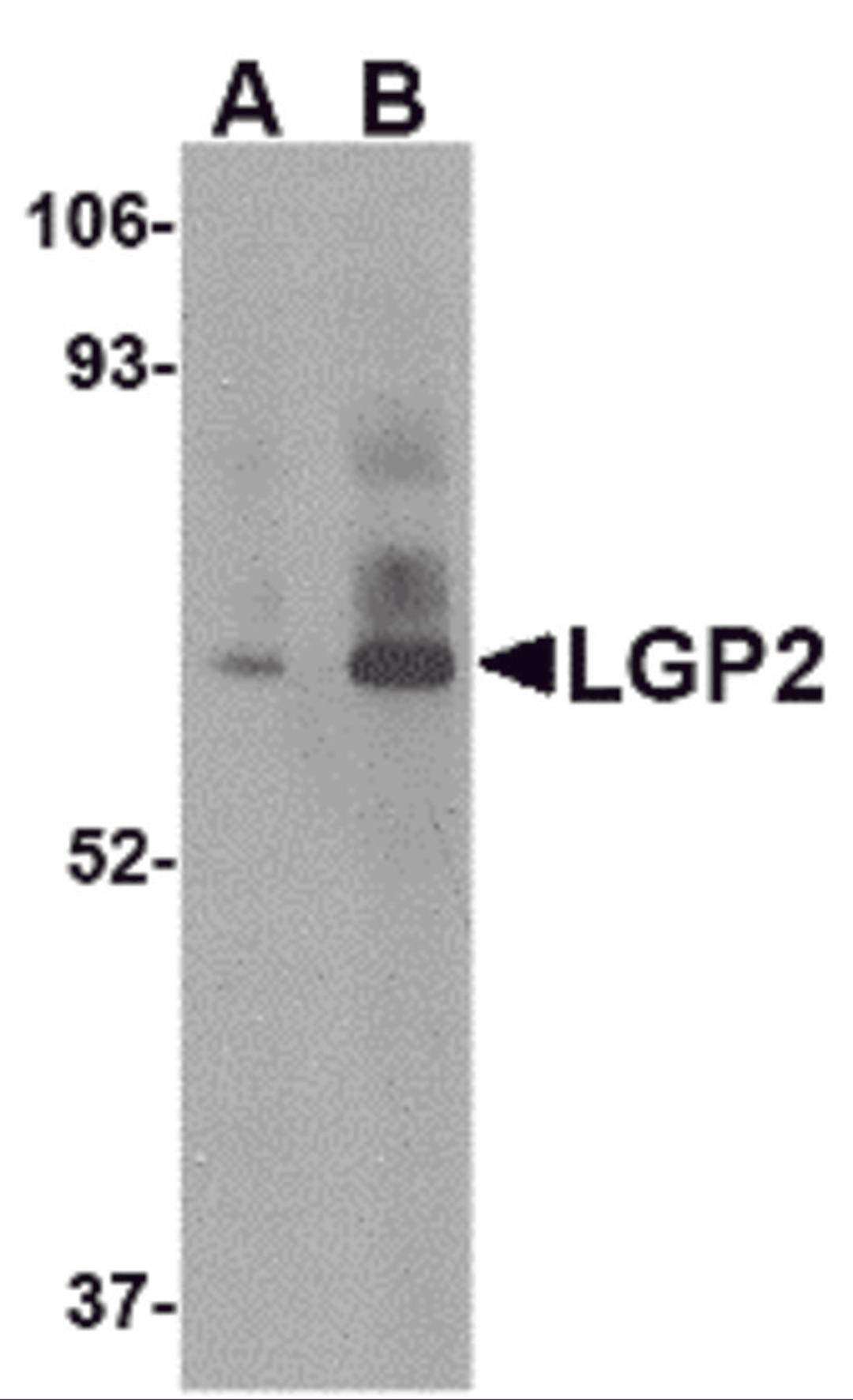 Western blot analysis of LGP2 in rat kidney tissue lysate with LGP2 antibody at (A) 1 and (B) 2 &#956;g/mL.