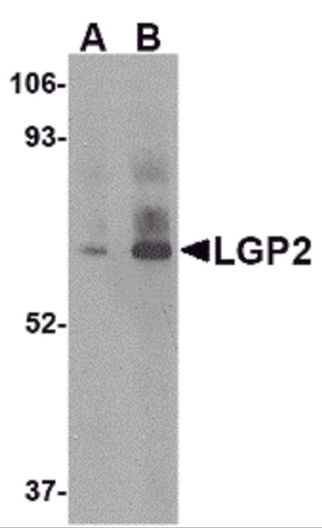 Western blot analysis of LGP2 in rat kidney tissue lysate with LGP2 antibody at (A) 1 and (B) 2 μg/mL.