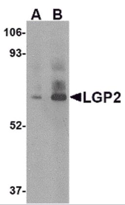 Western blot analysis of LGP2 in rat kidney tissue lysate with LGP2 antibody at (A) 1 and (B) 2 μg/mL.