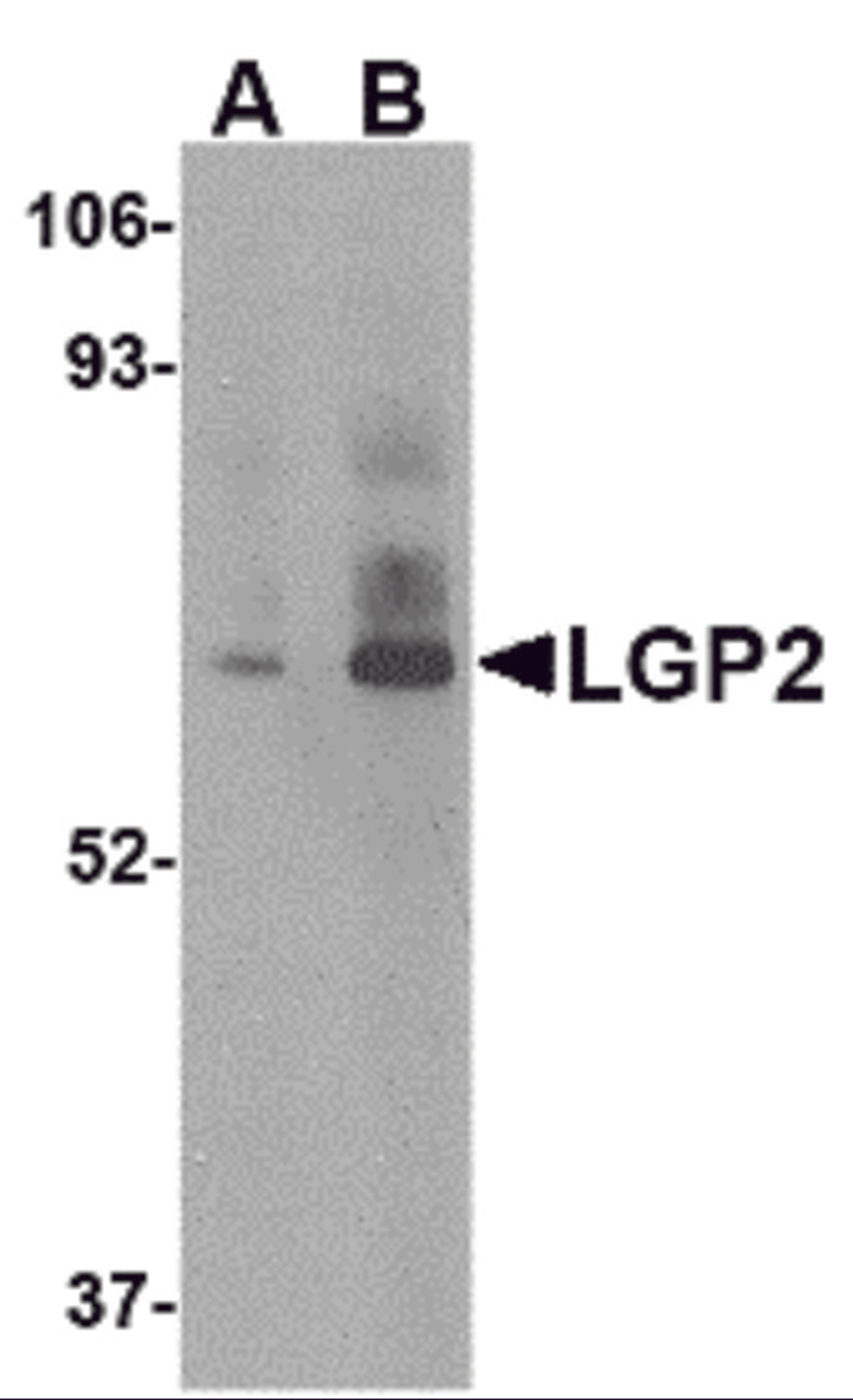 Western blot analysis of LGP2 in rat kidney tissue lysate with LGP2 antibody at (A) 1 and (B) 2 μg/mL.