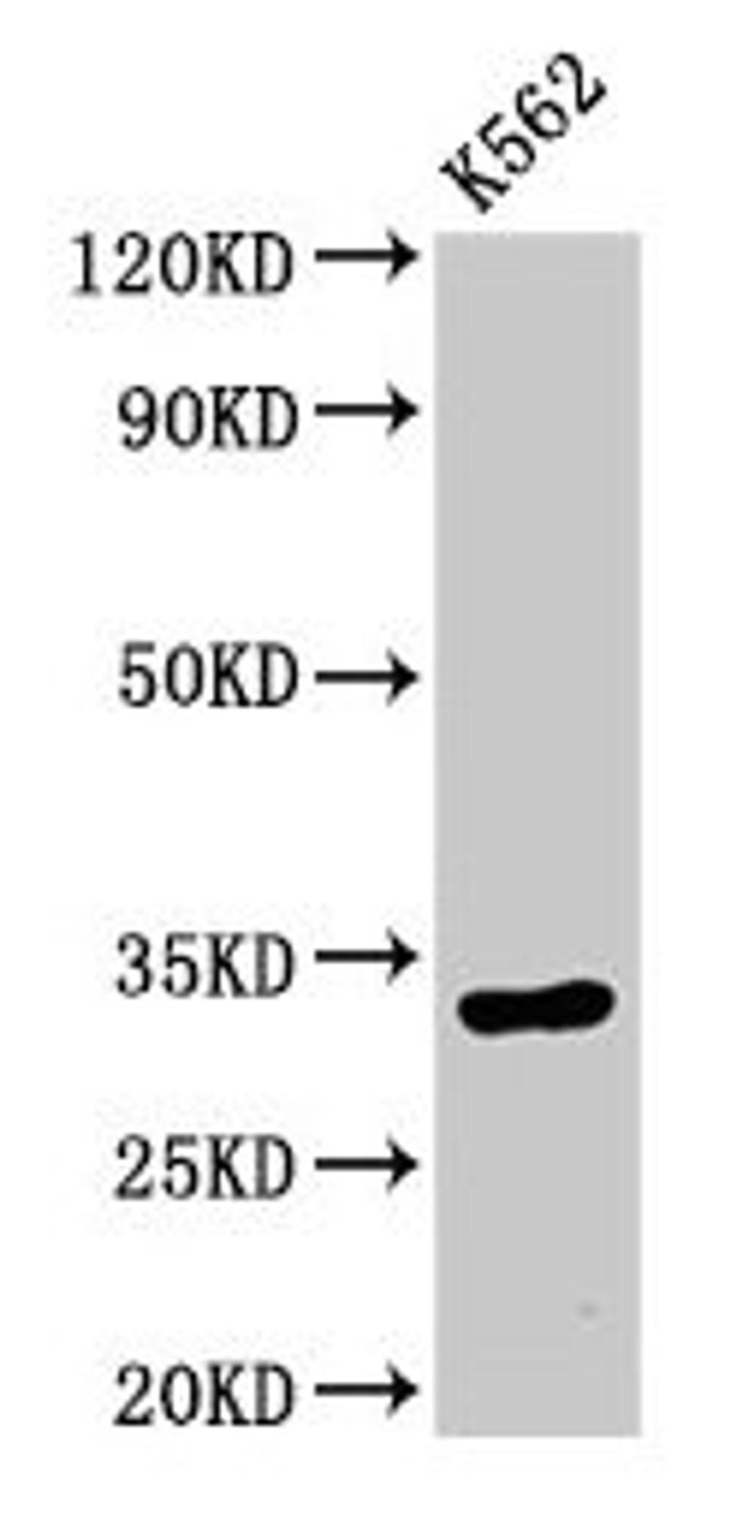 Western Blot. Positive WB detected in: K562 whole cell lysate. All lanes: HIST1H1E antibody at 0.5µg/ml. Secondary. Goat polyclonal to rabbit IgG at 1/50000 dilution. Predicted band size: 22 kDa. Observed band size: 32 kDa