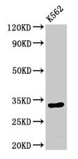Western Blot. Positive WB detected in: K562 whole cell lysate. All lanes: HIST1H1E antibody at 0.5µg/ml. Secondary. Goat polyclonal to rabbit IgG at 1/50000 dilution. Predicted band size: 22 kDa. Observed band size: 32 kDa