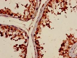 Immunohistochemistry of paraffin-embedded human testis tissue using CSB-PA892157LA01HU at dilution of 1:100