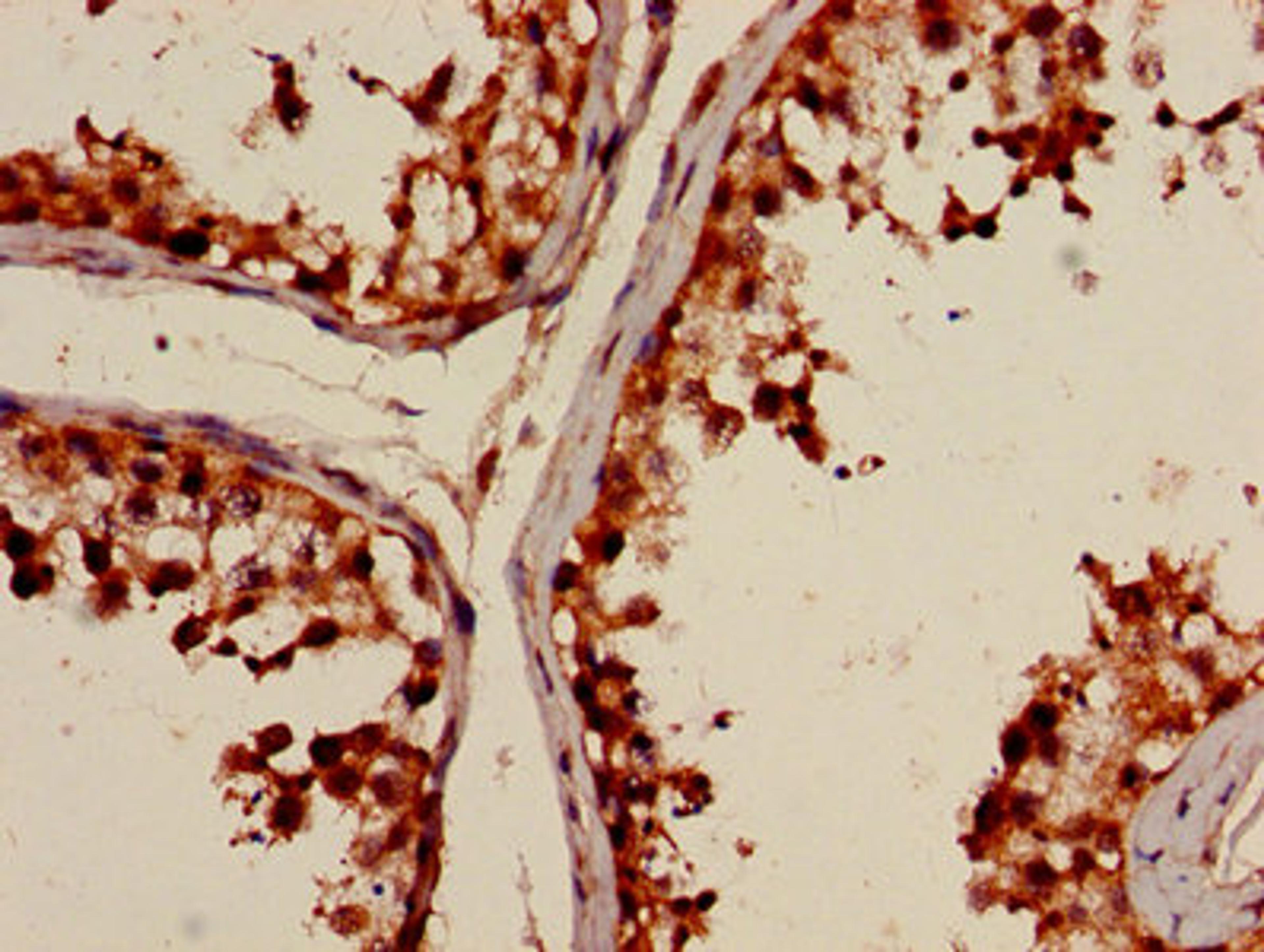 Immunohistochemistry of paraffin-embedded human testis tissue using CSB-PA892157LA01HU at dilution of 1:100