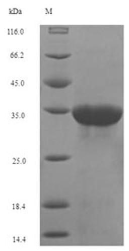 (Tris-Glycine gel) Discontinuous SDS-PAGE (reduced) with 5% enrichment gel and 15% separation gel.