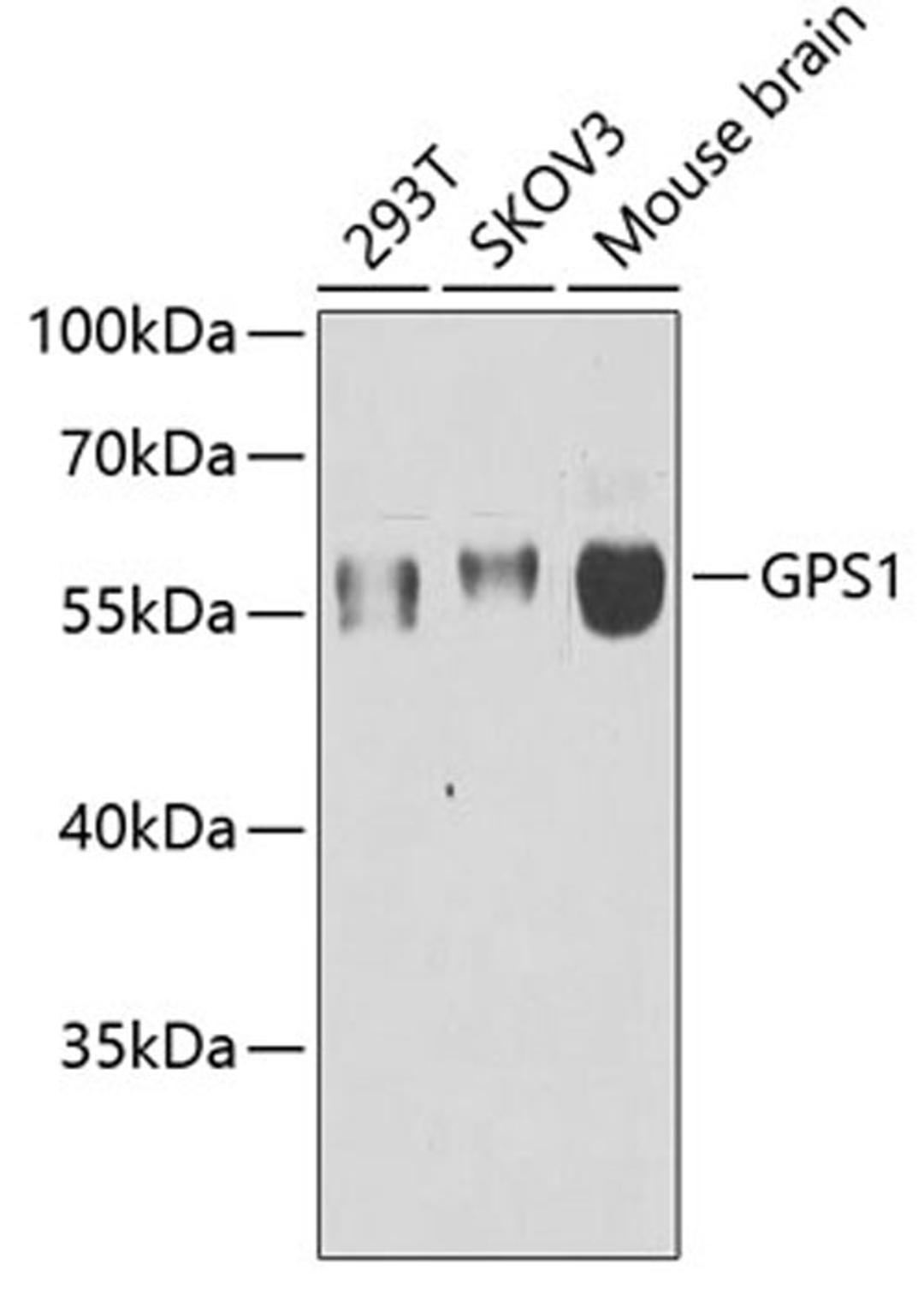 Western blot - GPS1 antibody (A6917)