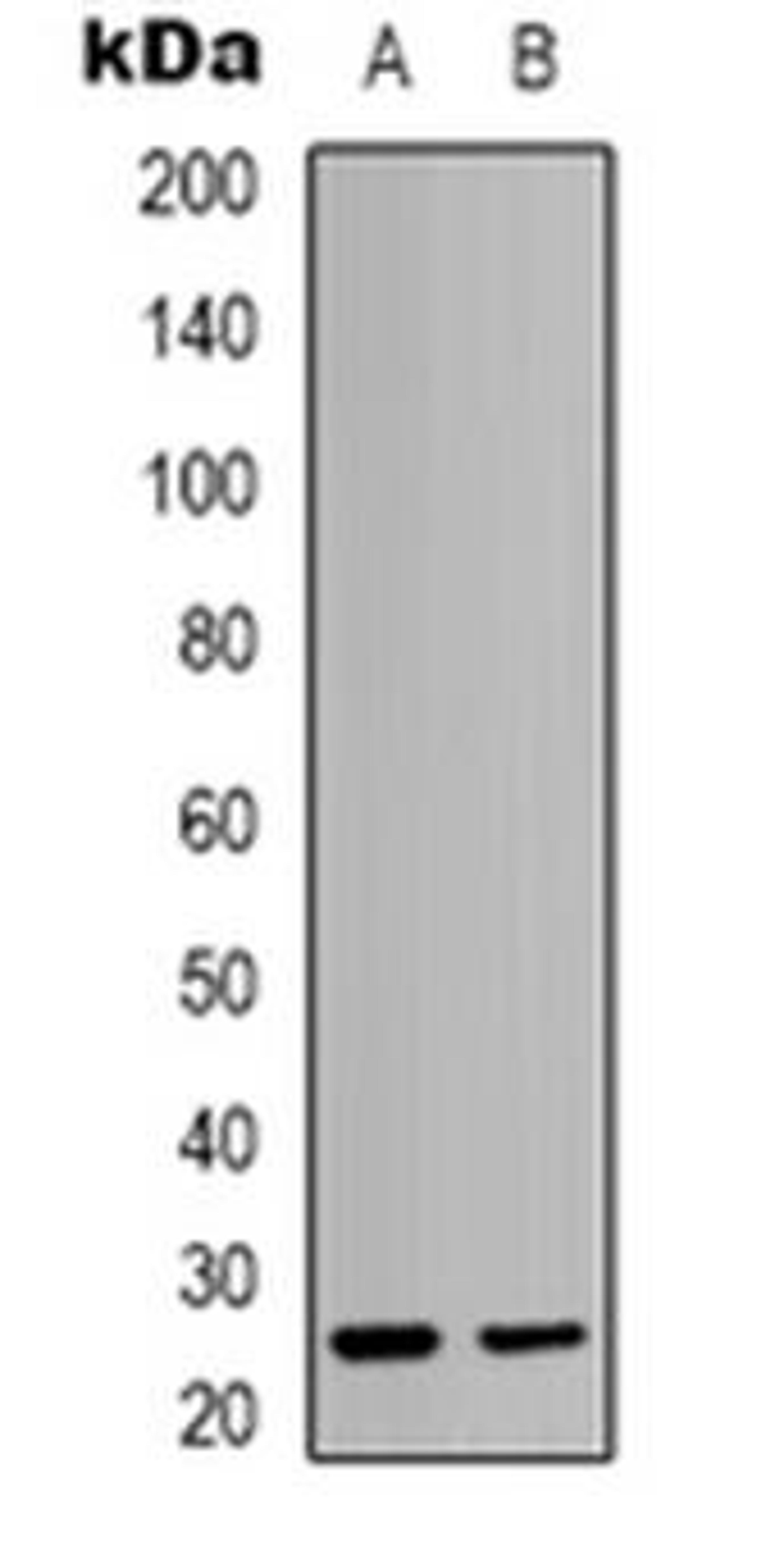 Western blot analysis of HMGB2 expression in Hela (Lane 1), K562 (Lane 2) whole cell lysates using HMGB2 antibody