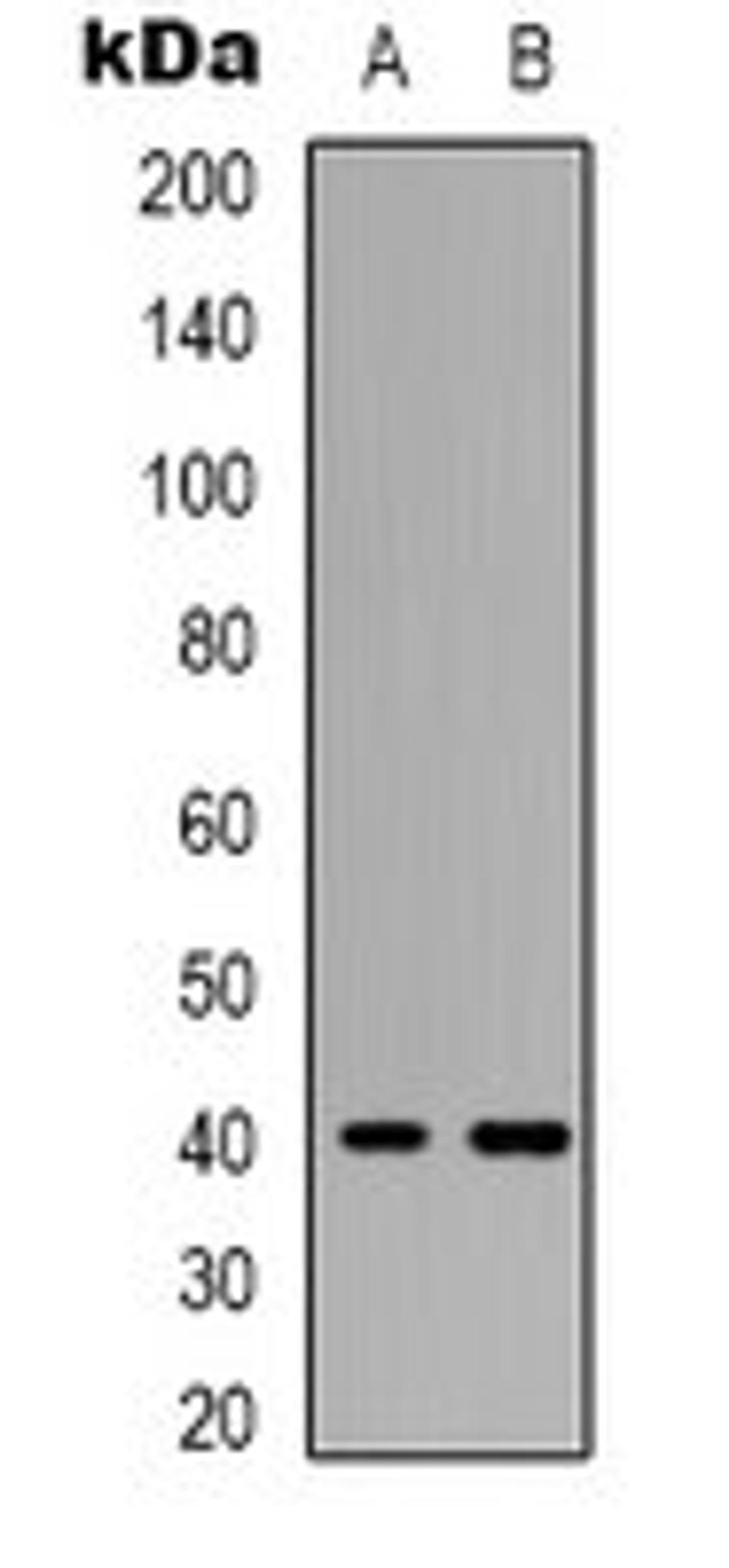 Western blot analysis of A549 (Lane 1), COLO205 (Lane 2) whole cell lysates using mPR alpha antibody