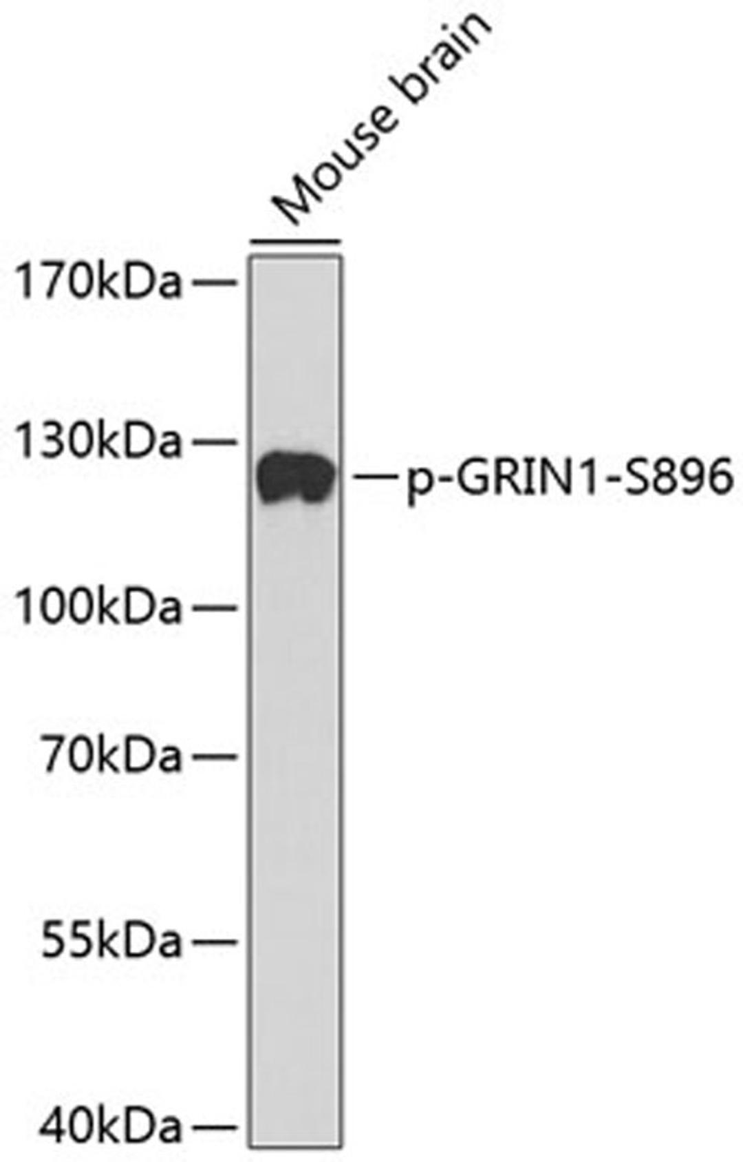 Western blot - phospho-GRIN1-S896 antibody (AP0165)