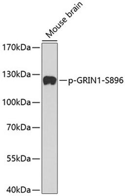 Western blot - phospho-GRIN1-S896 antibody (AP0165)