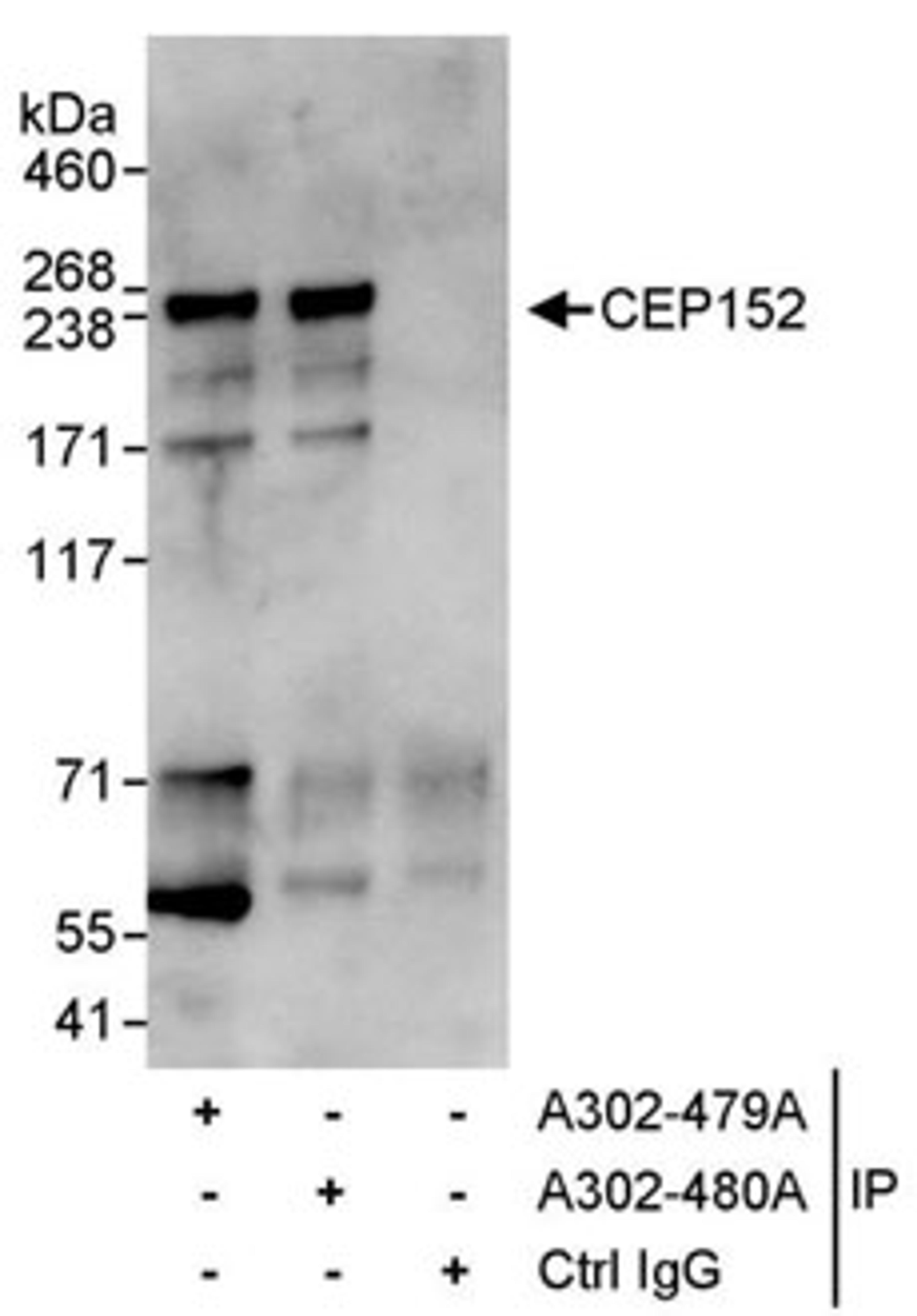 Detection of human CEP152 by western blot of immunoprecipitates.