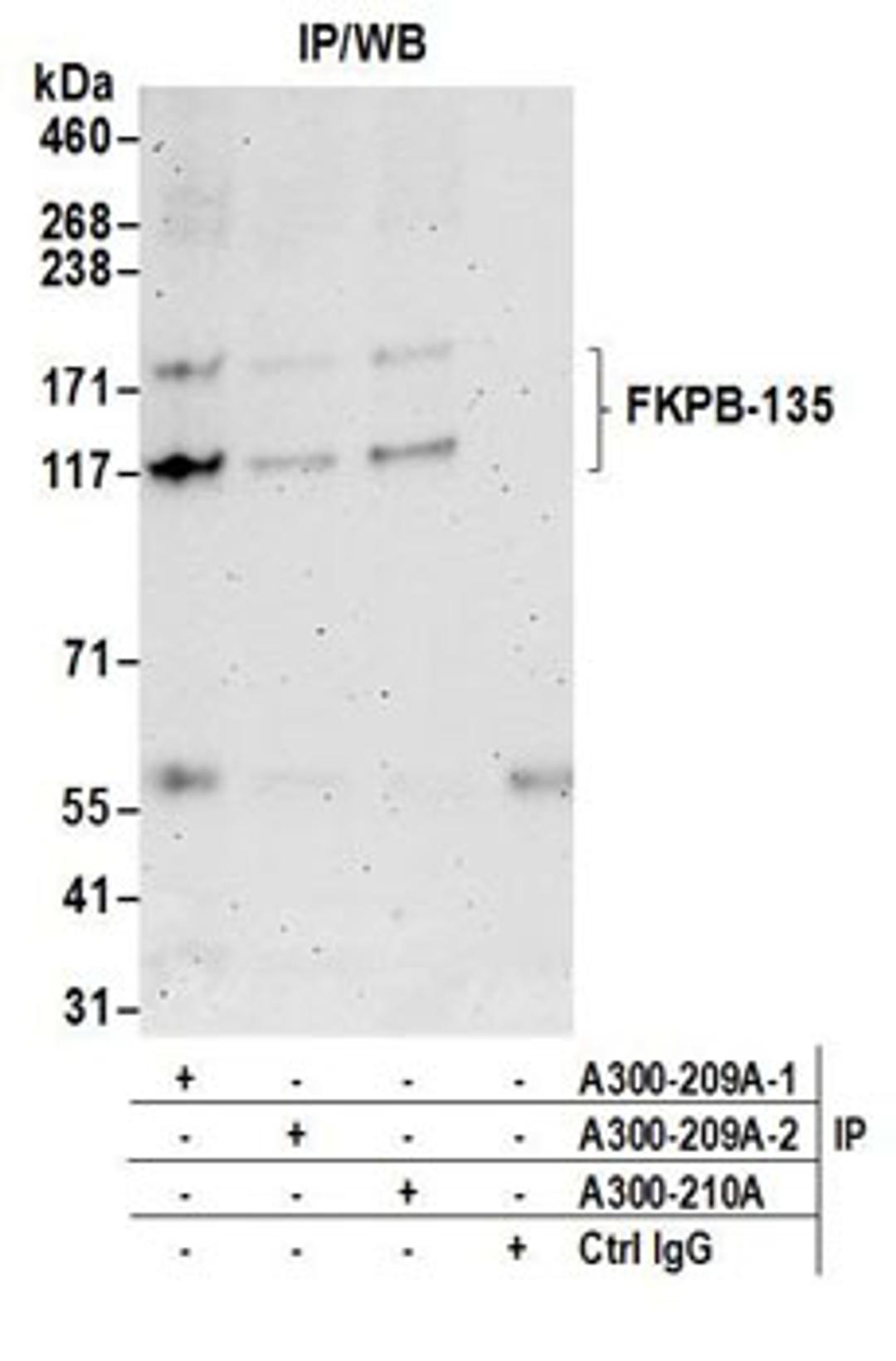 Detection of human FKPB-135 by western blot of immunoprecipitates.