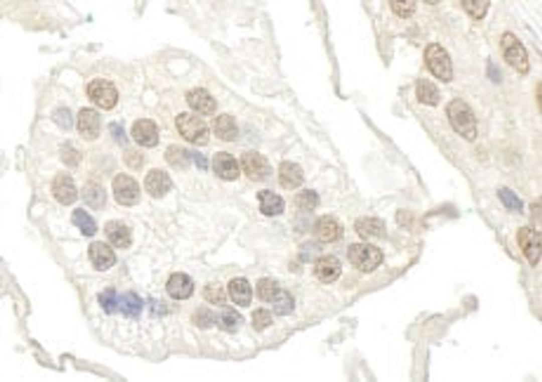 Detection of human BRD7 by immunohistochemistry.