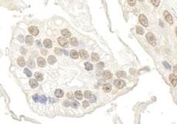 Detection of human BRD7 by immunohistochemistry.