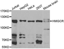 Western blot analysis of extracts of various cell lines using HMGCR antibody