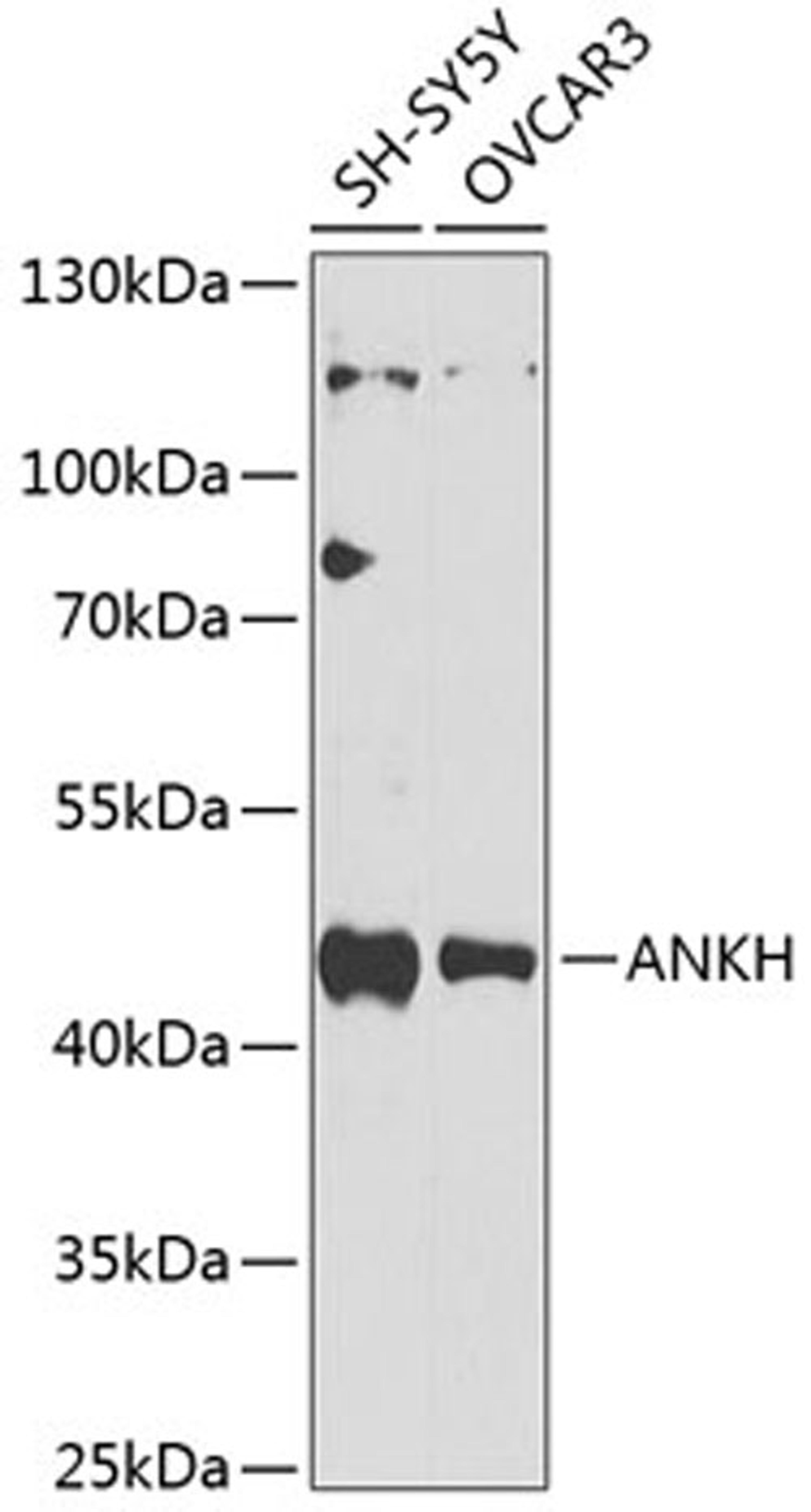 Western blot - ANKH Antibody (A9881)