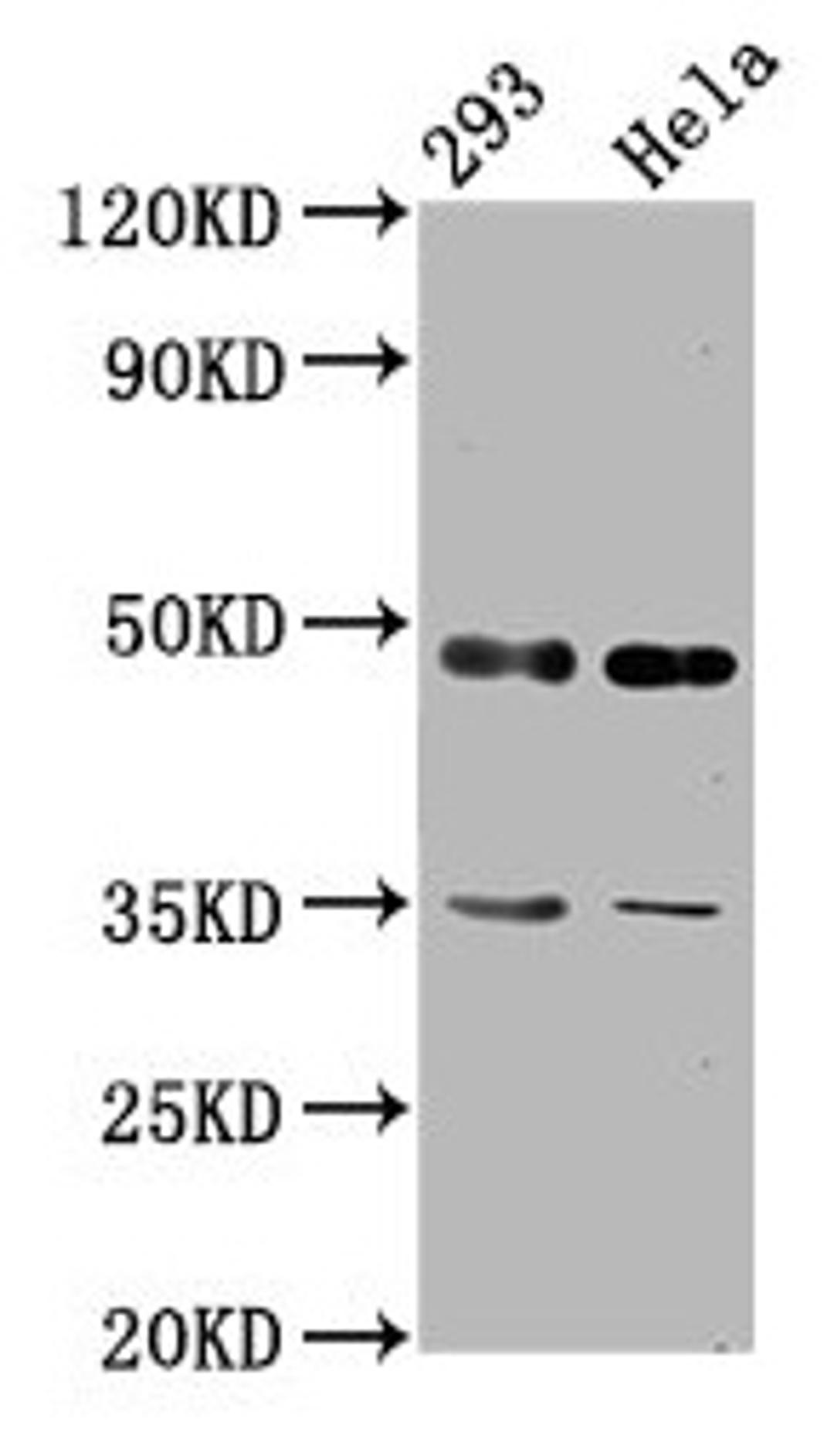 Western Blot. Positive WB detected in: 293 whole cell lysate, Hela whole cell lysate. All lanes: TES antibody at 2.92µg/ml. Secondary. Goat polyclonal to rabbit IgG at 1/50000 dilution. Predicted band size: 48, 47 kDa. Observed band size: 48 kDa