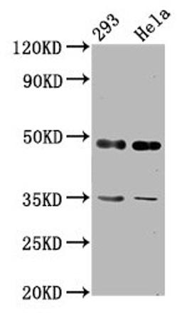 Western Blot. Positive WB detected in: 293 whole cell lysate, Hela whole cell lysate. All lanes: TES antibody at 2.92µg/ml. Secondary. Goat polyclonal to rabbit IgG at 1/50000 dilution. Predicted band size: 48, 47 kDa. Observed band size: 48 kDa